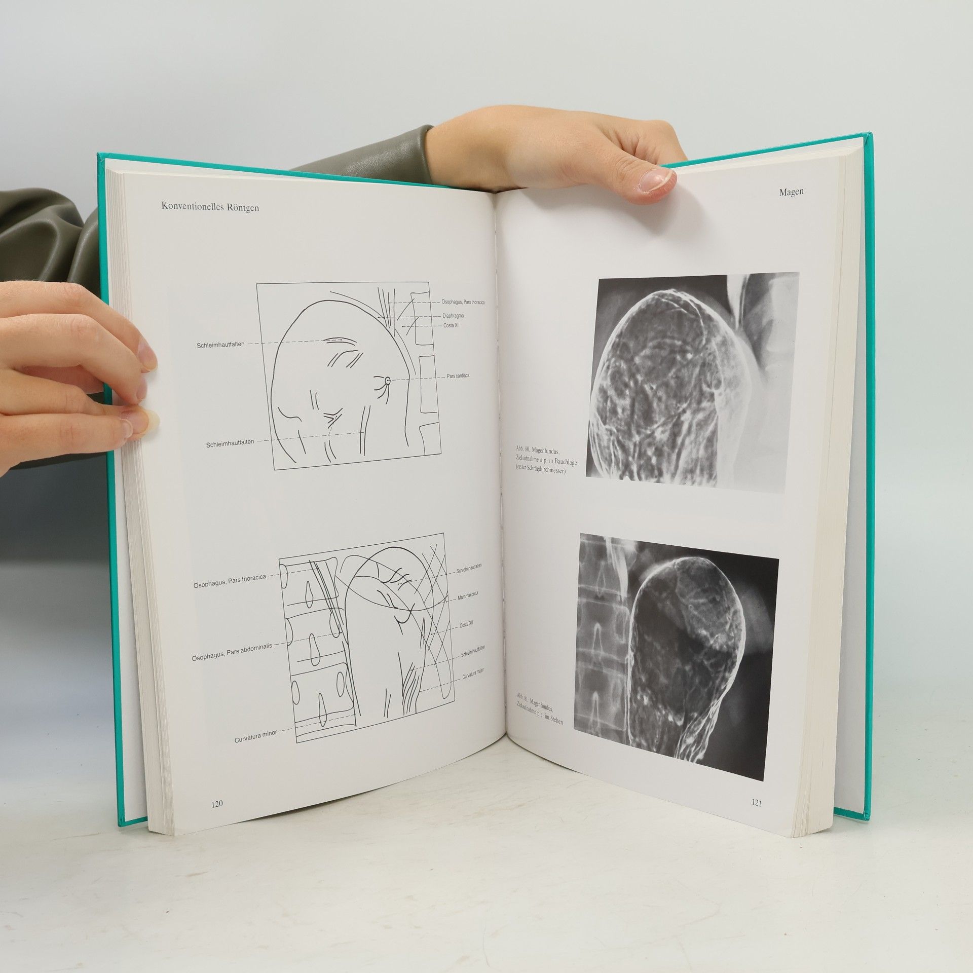 Lothar Wicke Röntgen-Anatomie