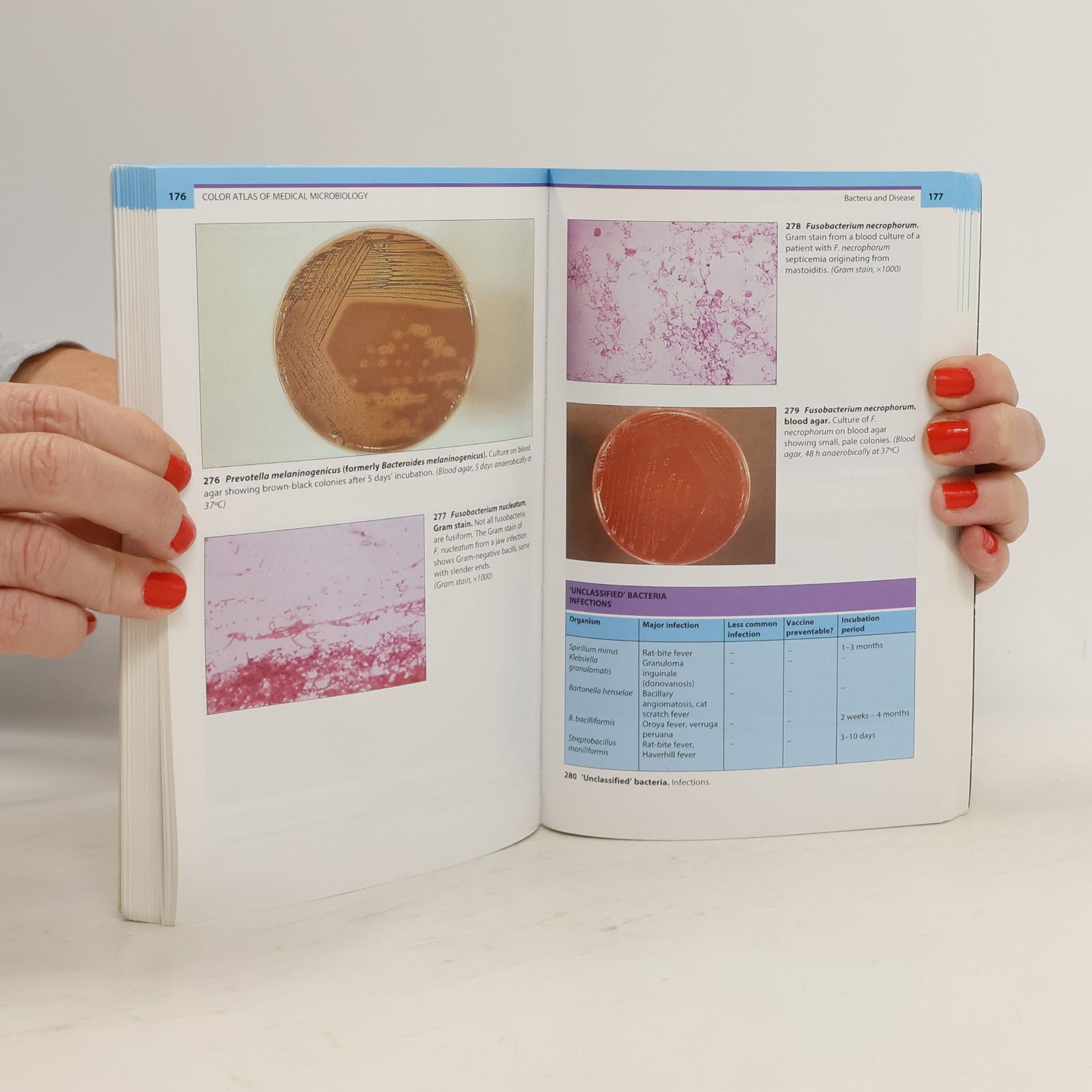 C. Anthony Hart Diagnosis in Colour: Color Atlas of Medical Microbiology