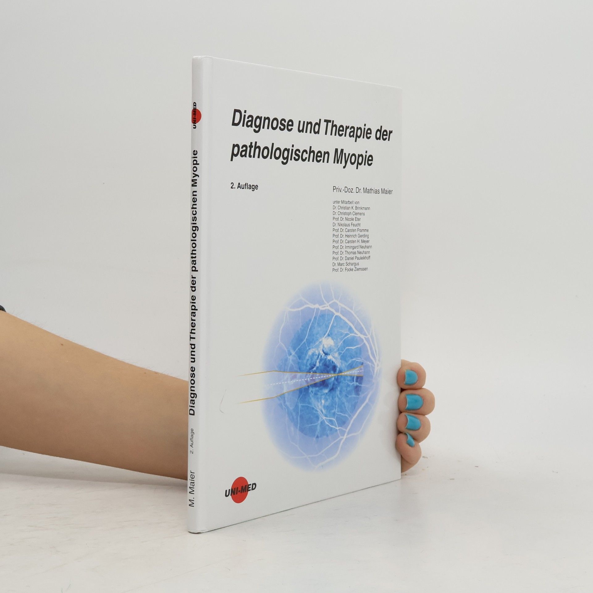Marc Schargus Diagnose und Therapie der pathologischen Myopie - 2. Auflage