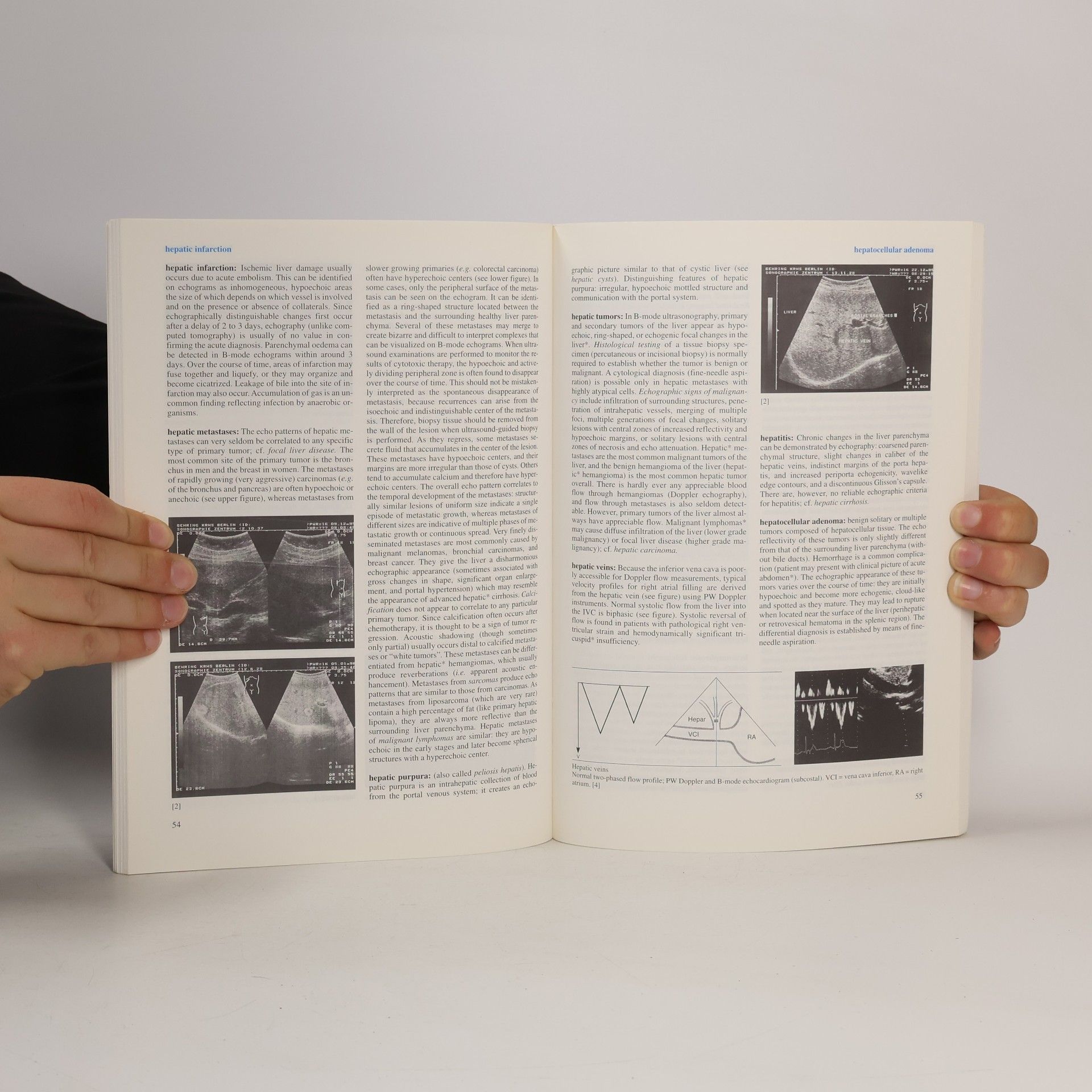 Various authors Dictionary of Ultrasound