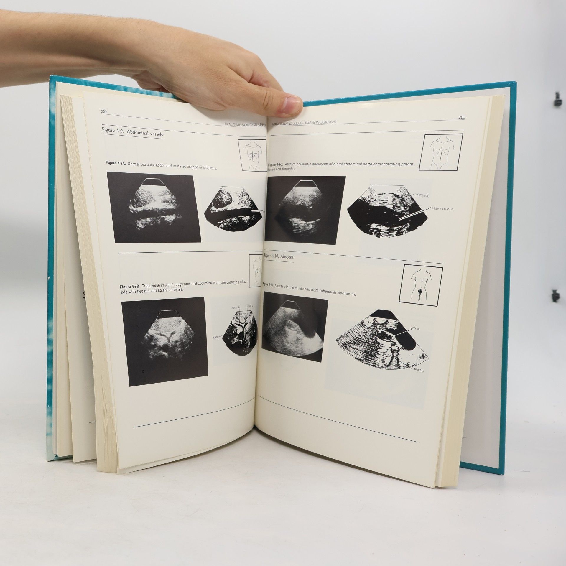 Arthur C. Fleischer Real-Time Sonography