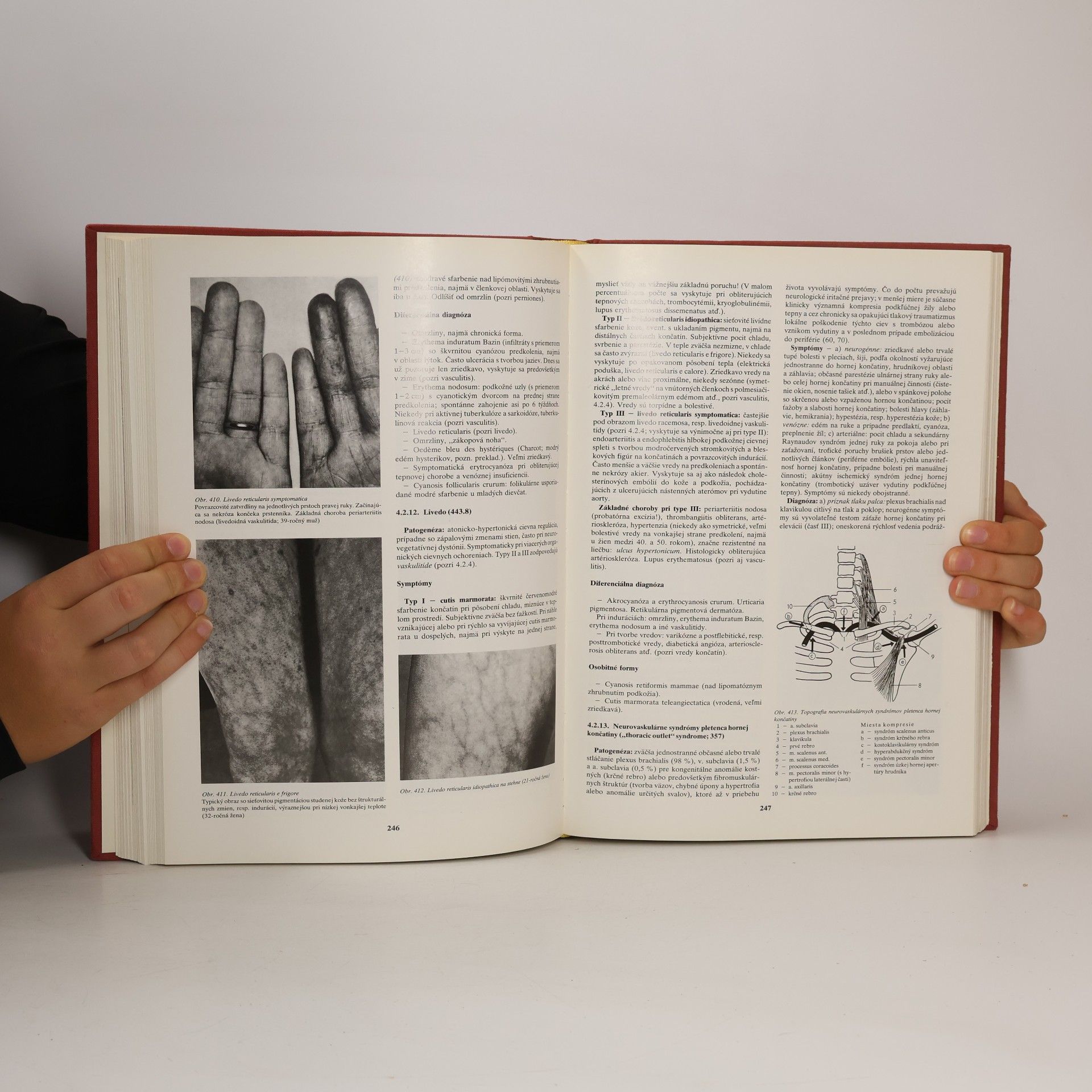 Arnold Kappert Angiológia učebnica a atlas. Choroby tepien, žíl, vlásočníc a lymfatických ciev