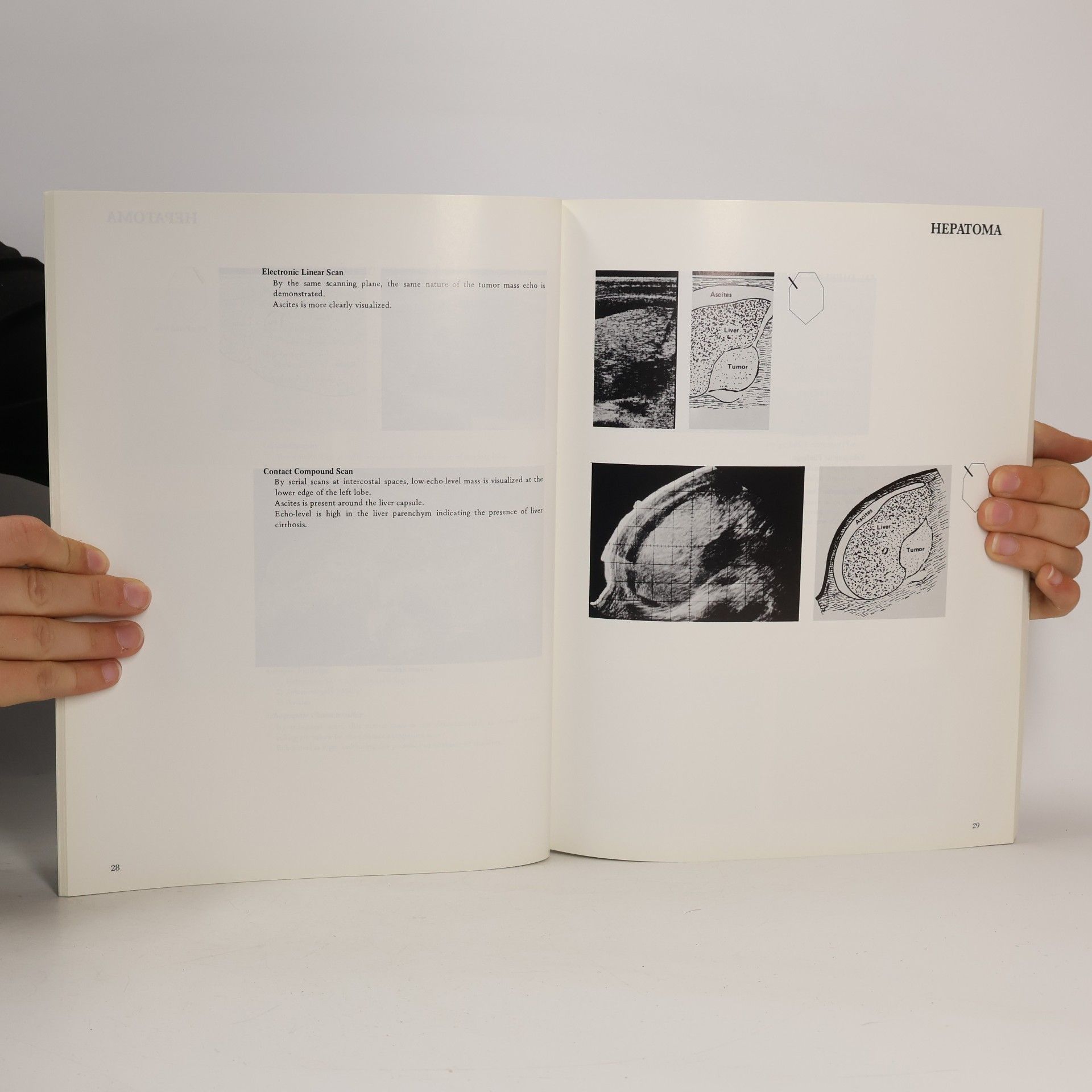 Toshiji Kobayashi Clinical Sonographic Atlas by Electronic Linear Scanning