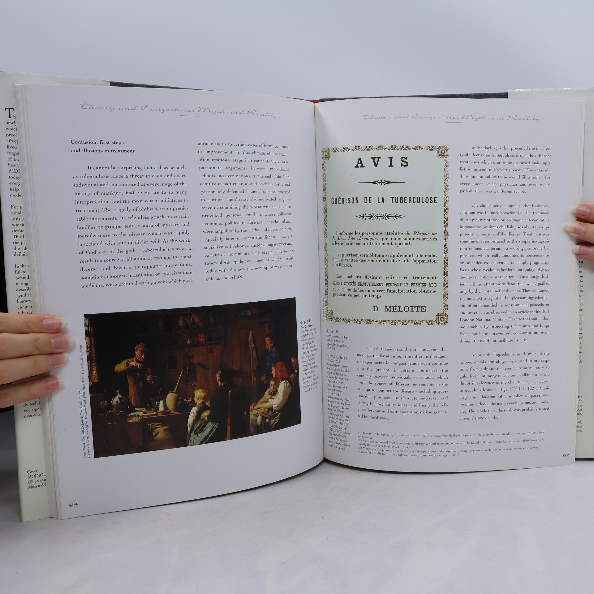 Jacques Chrétien Tuberculosis. The illustrated history of a disease I