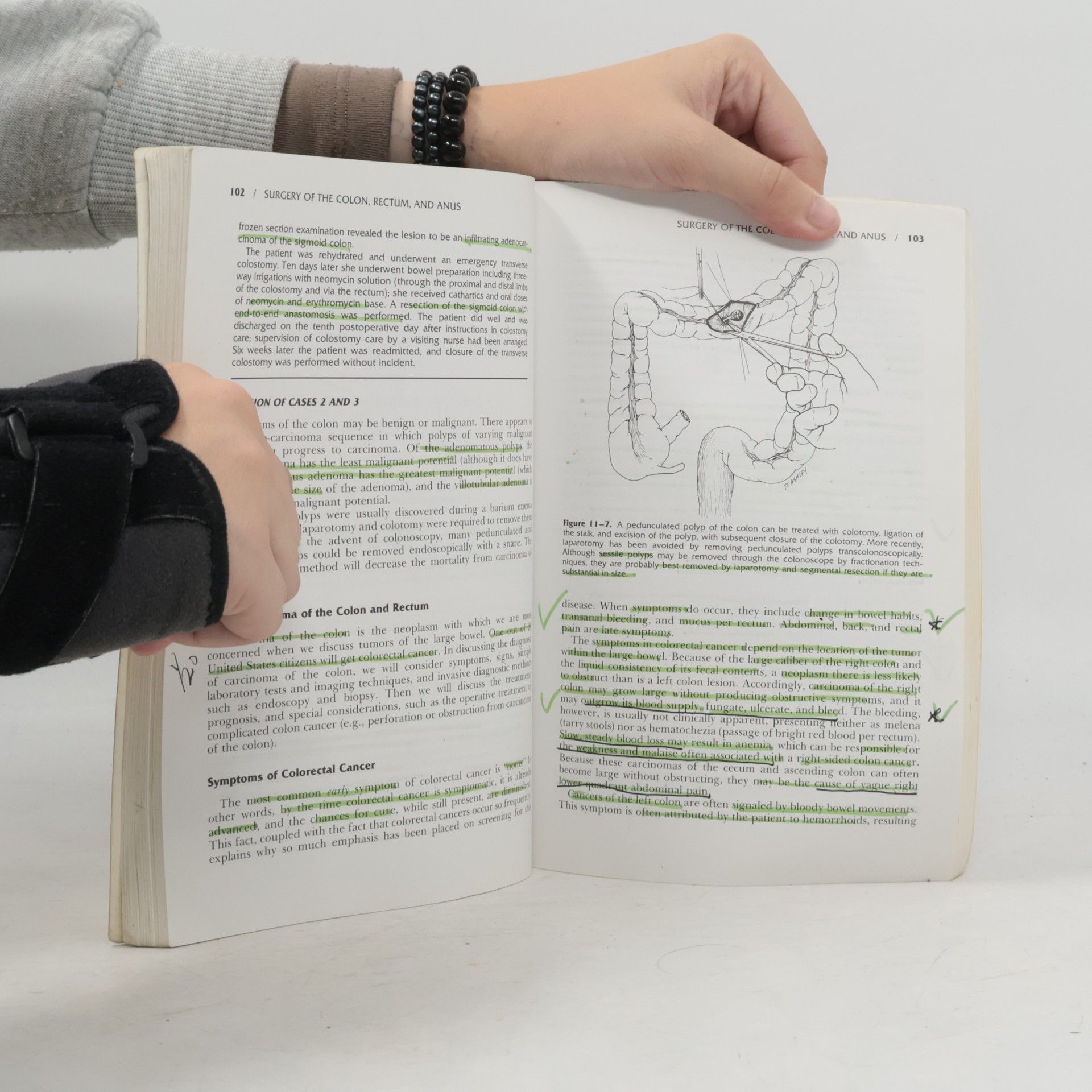 David H. Levien Introduction to Surgery - Second Edition