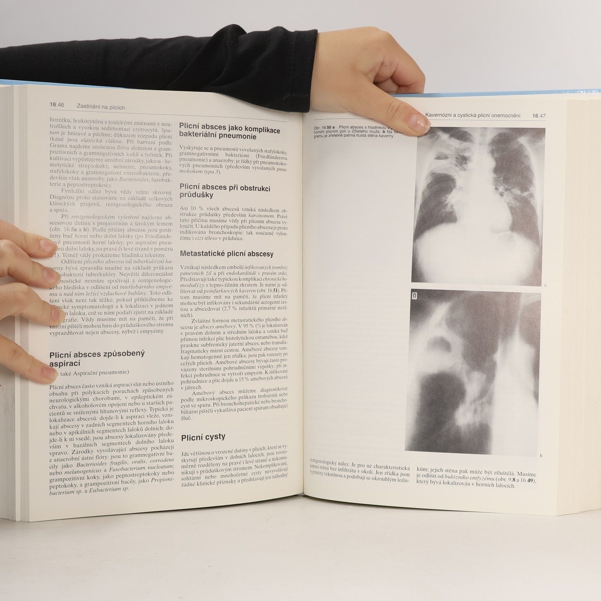 Walter Siegenthaler Diferenciální diagnostika vnitřních chorob