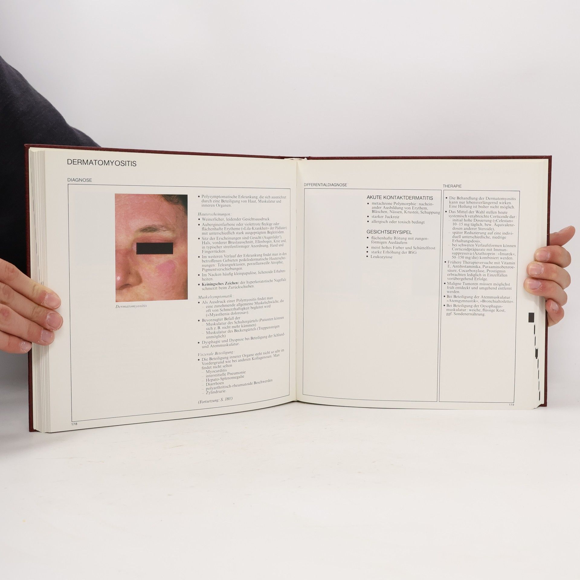 Autorenkollektiv Praktische Dermatologie. Diproderm. Diprogenta