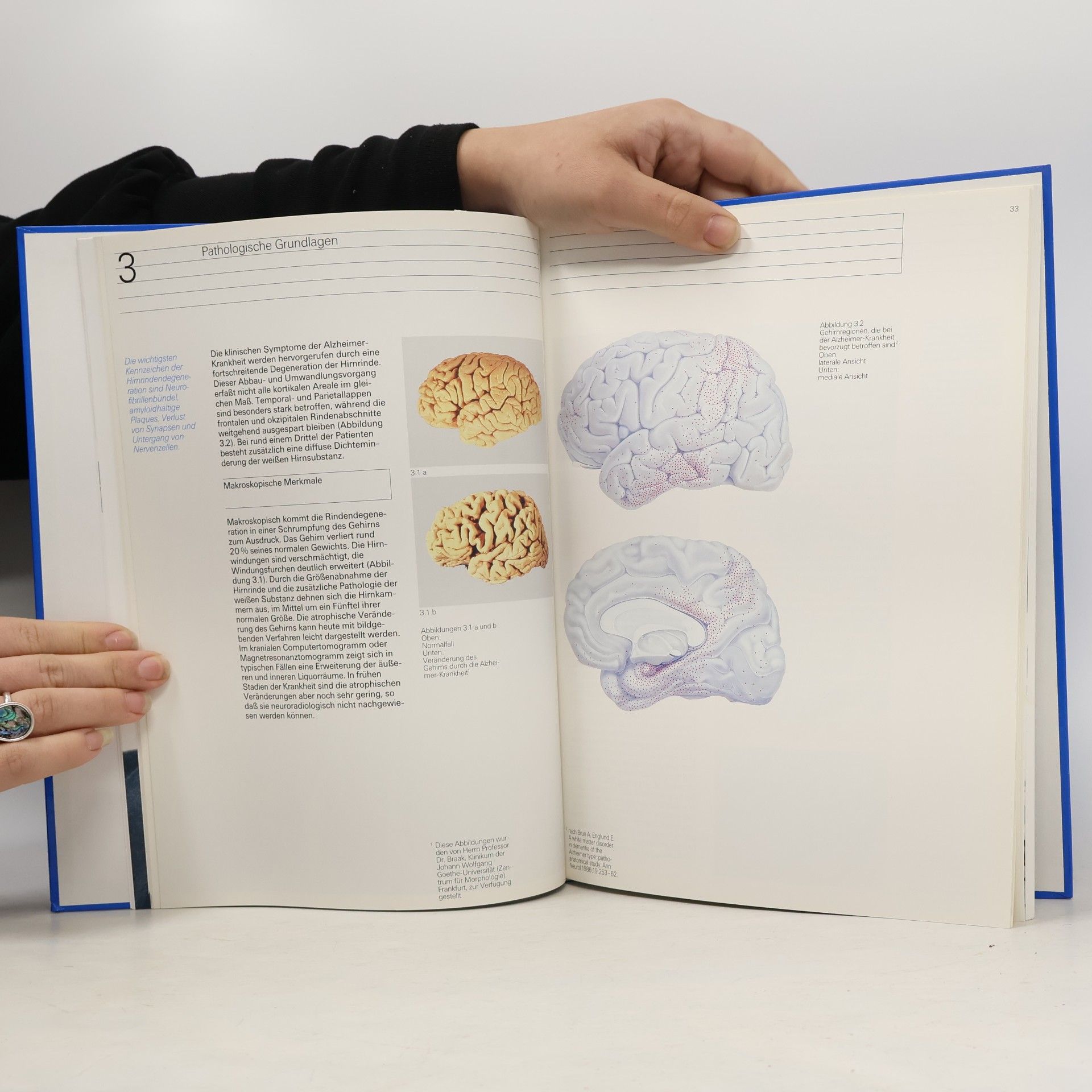 Various authors Alzheimer-Patienten erkennen und behandeln