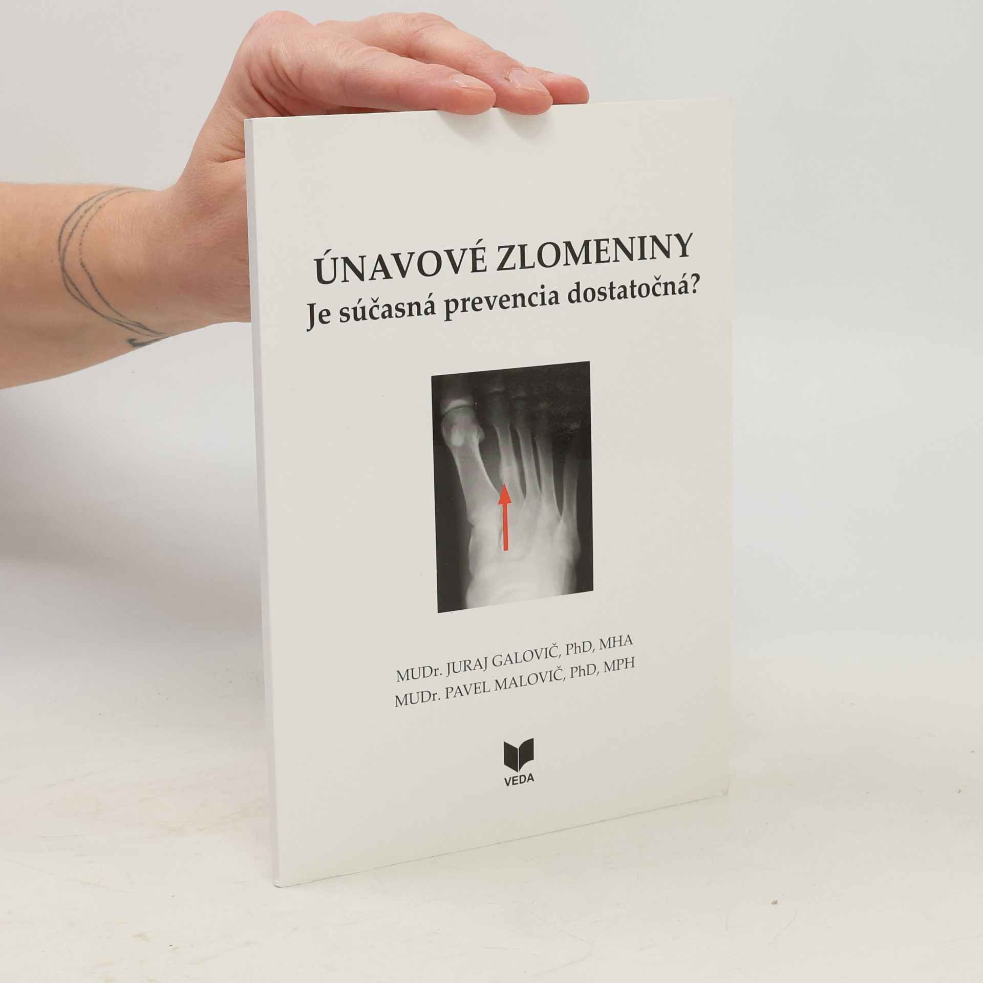 Juraj Galovič Únavové zlomeniny