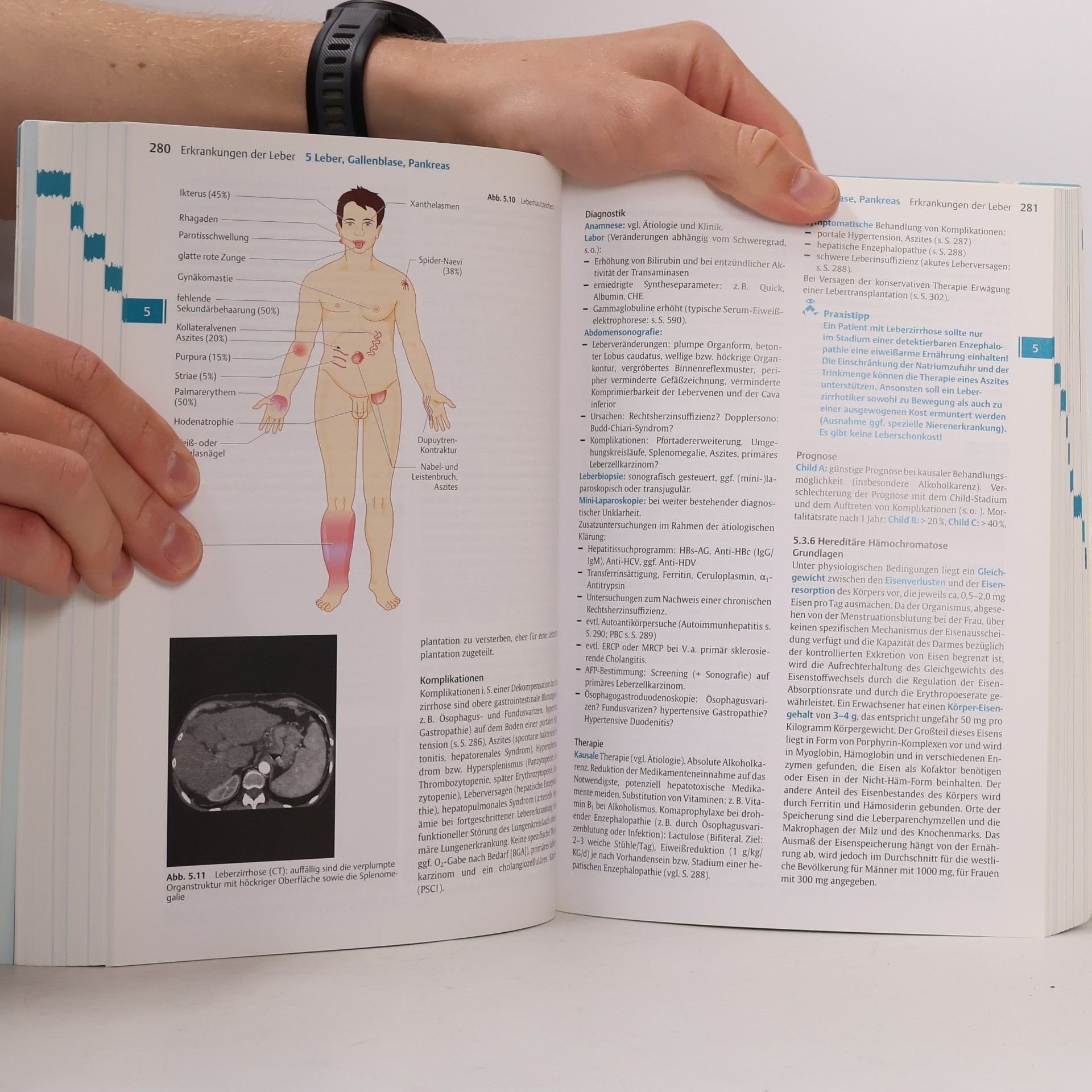 Hanns-Wolf Baenkler Kurzlehrbuch Innere Medizin