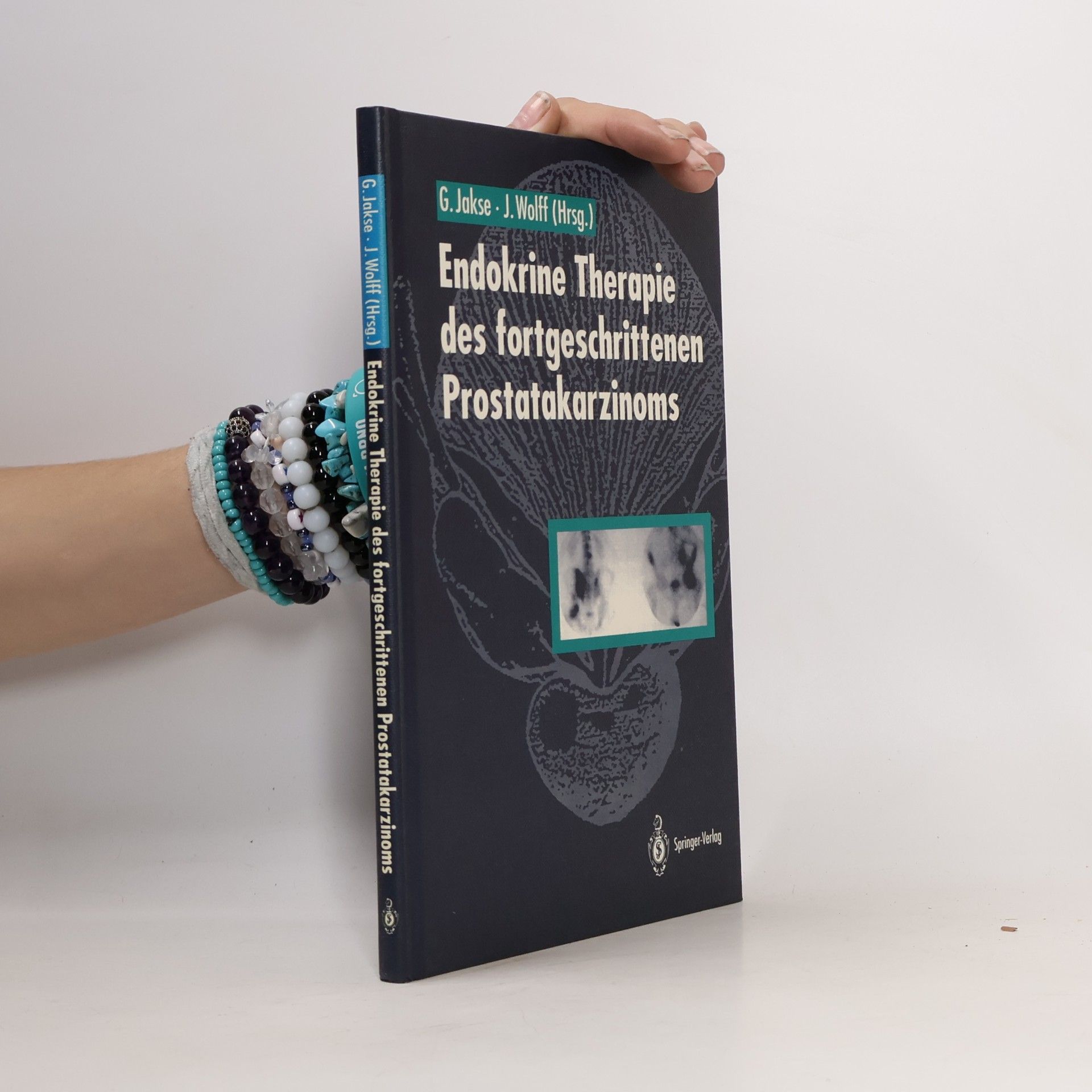 Endokrine Therapie des fortgeschrittenen Prostatakarzinoms