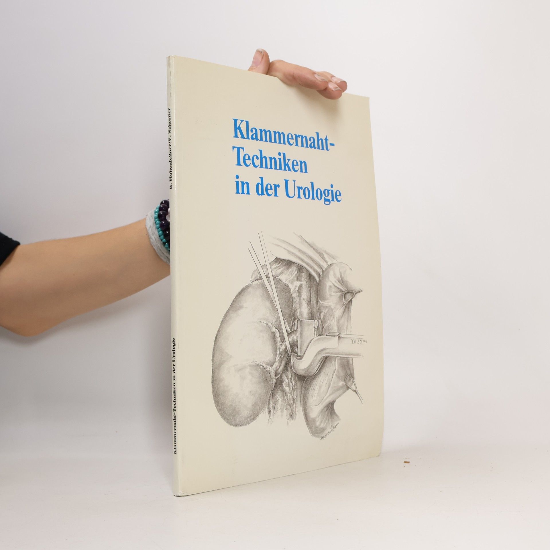 Klammernaht-Techniken in der Urologie