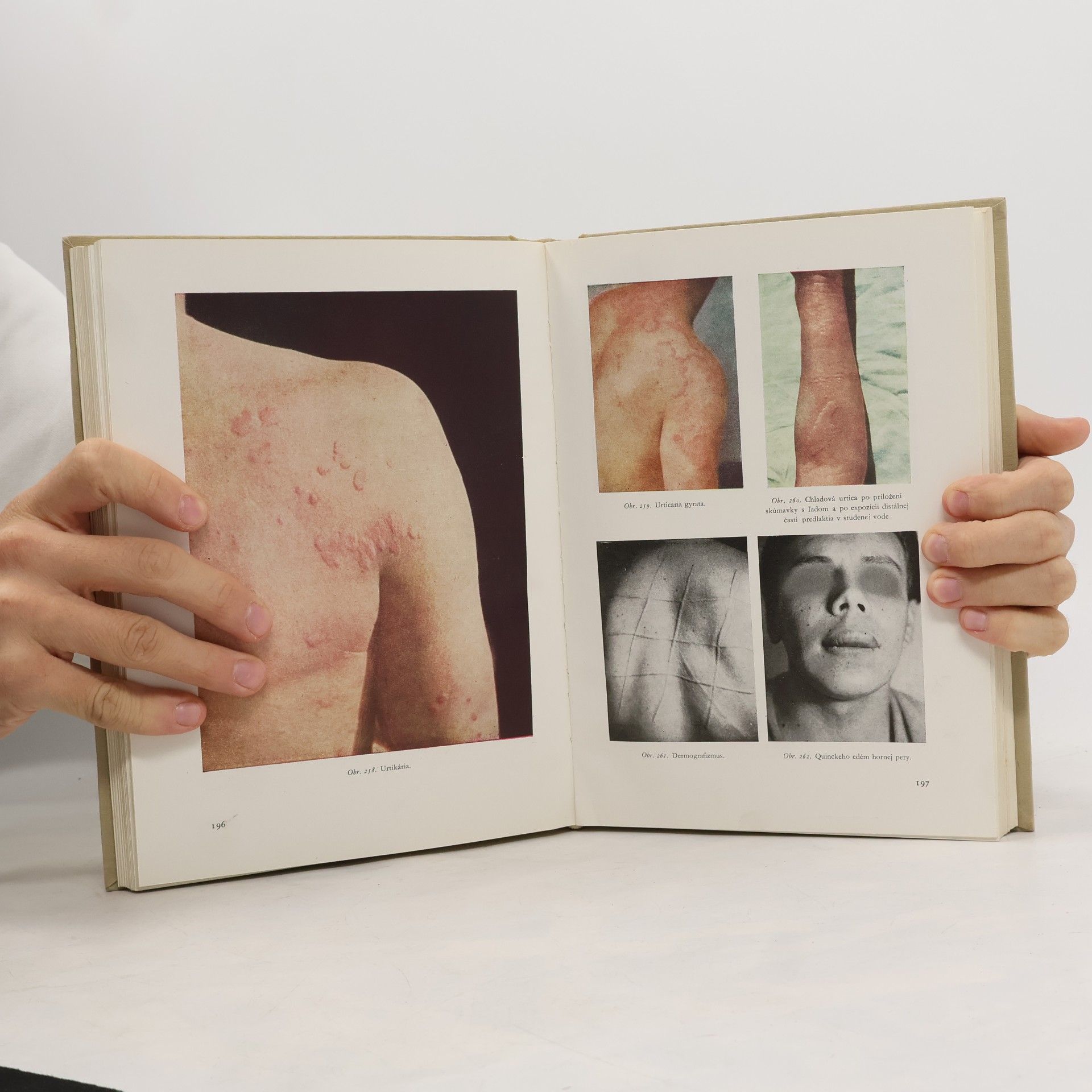 Alexander Rehák Diagnostický atlas kožných chorôb
