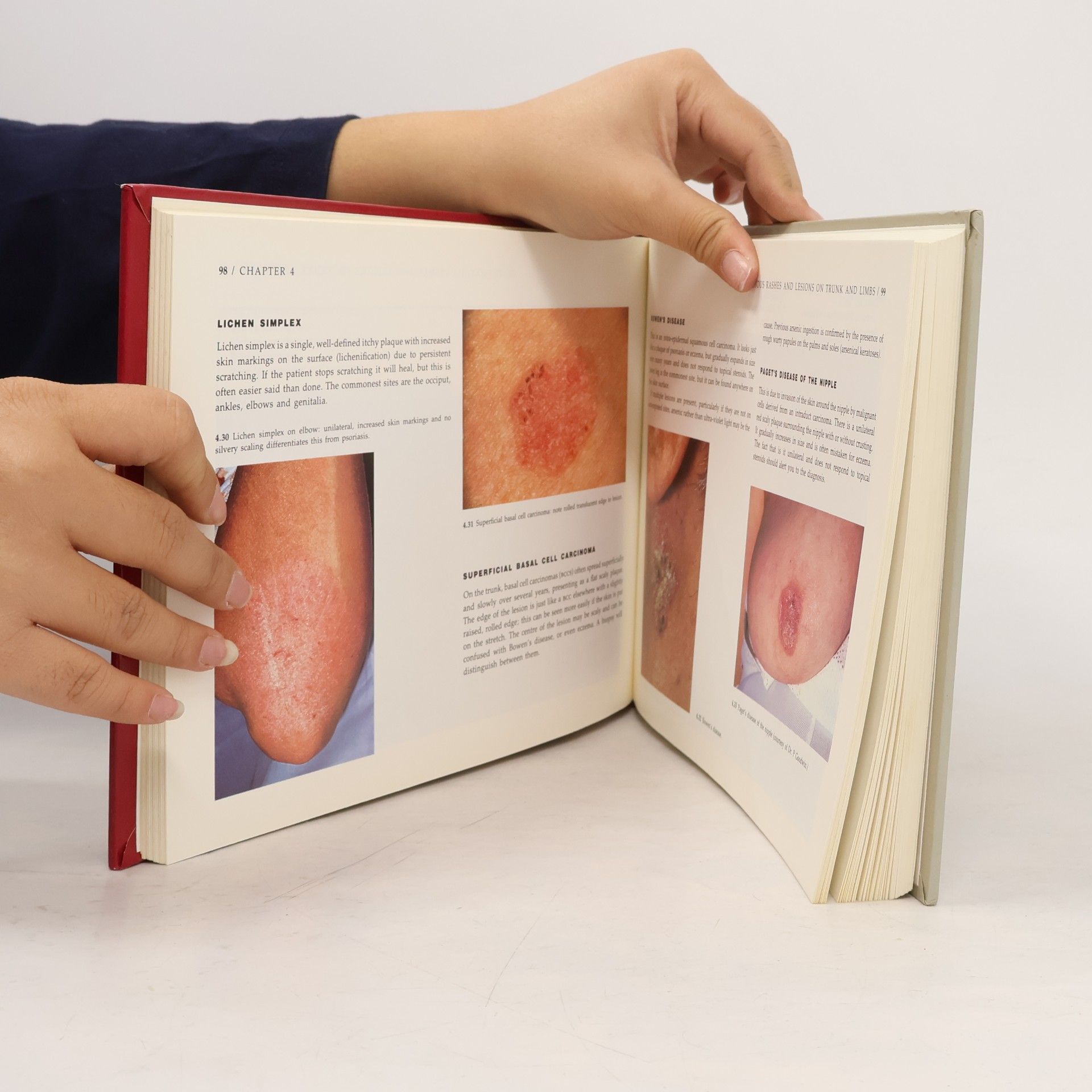 Richard Ashton Differential Diagnosis in Dermatology