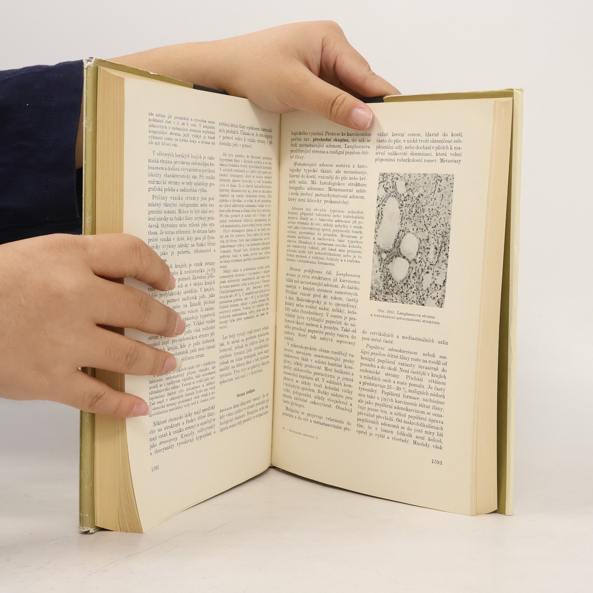 Various authors Patologická anatomie II/2