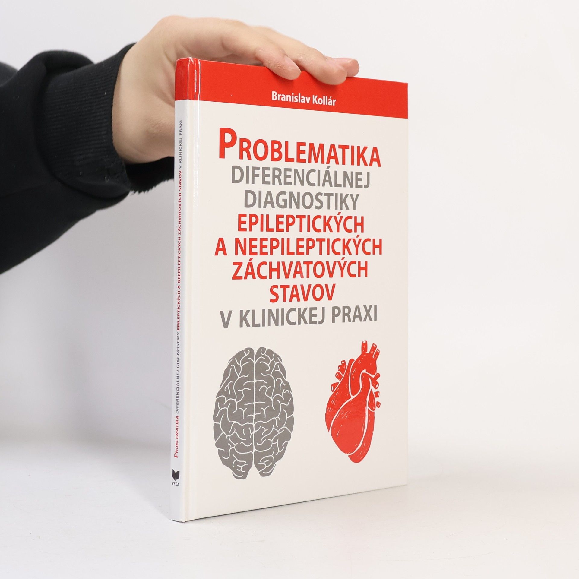 Problematika diferenciálnej diagnostiky epileptických a neepileptických záchvatových stavov v klinickej praxi