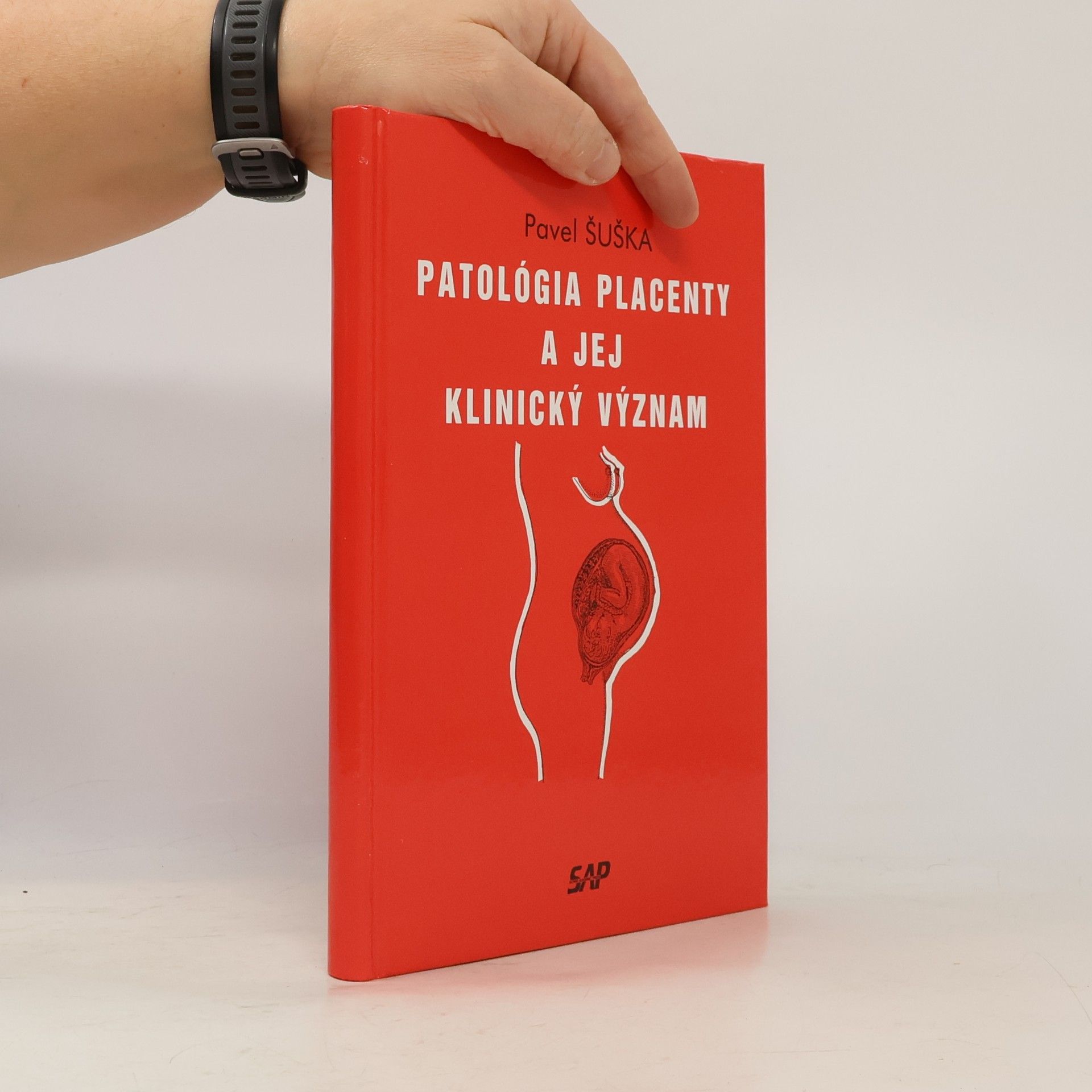 Patológia placenty a jej klinický význam