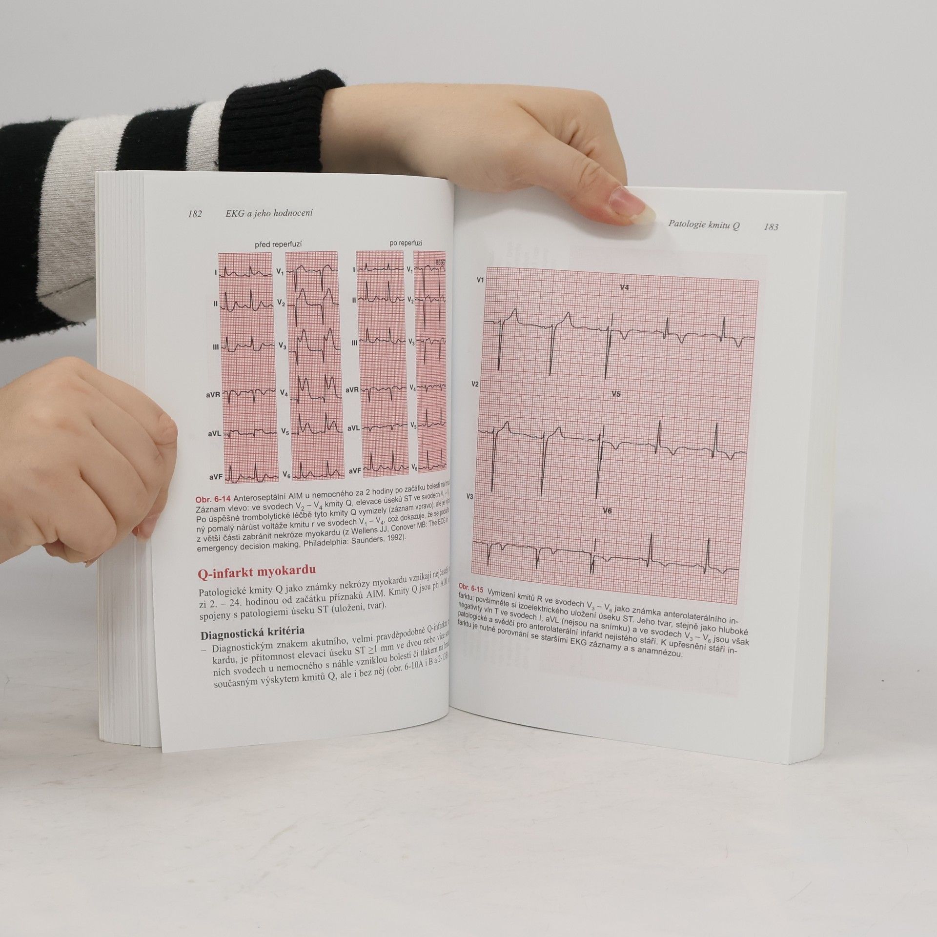 M. I. Gabriel Khan EKG a jeho hodnocení