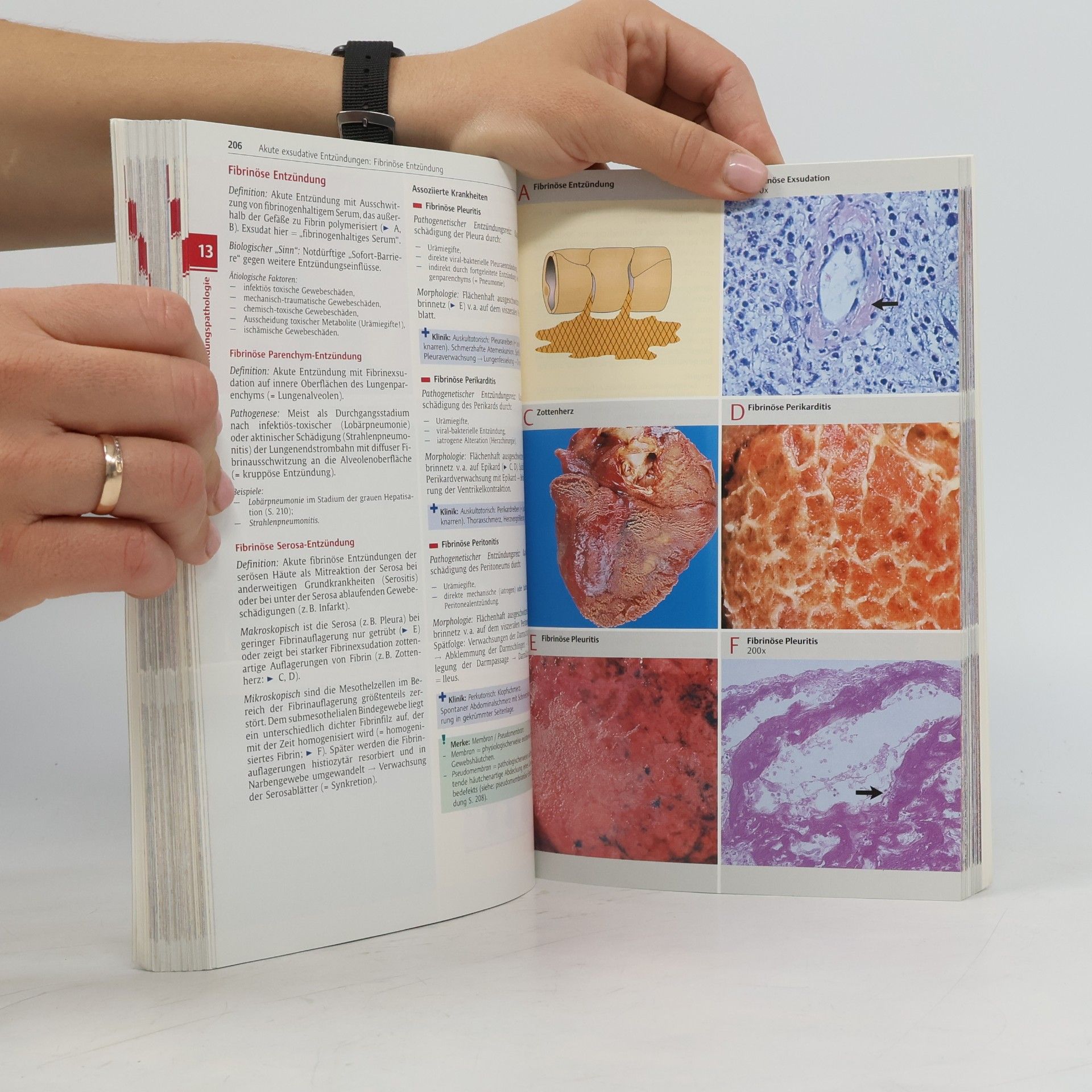 Ursus Nikolaus Riede Taschenatlas der allgemeinen Pathologie