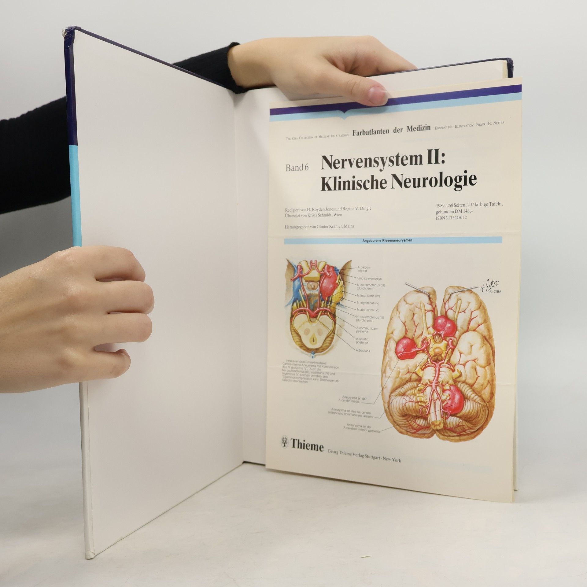 Frank H. Netter Nervensystem II. Klinische Neurologie
