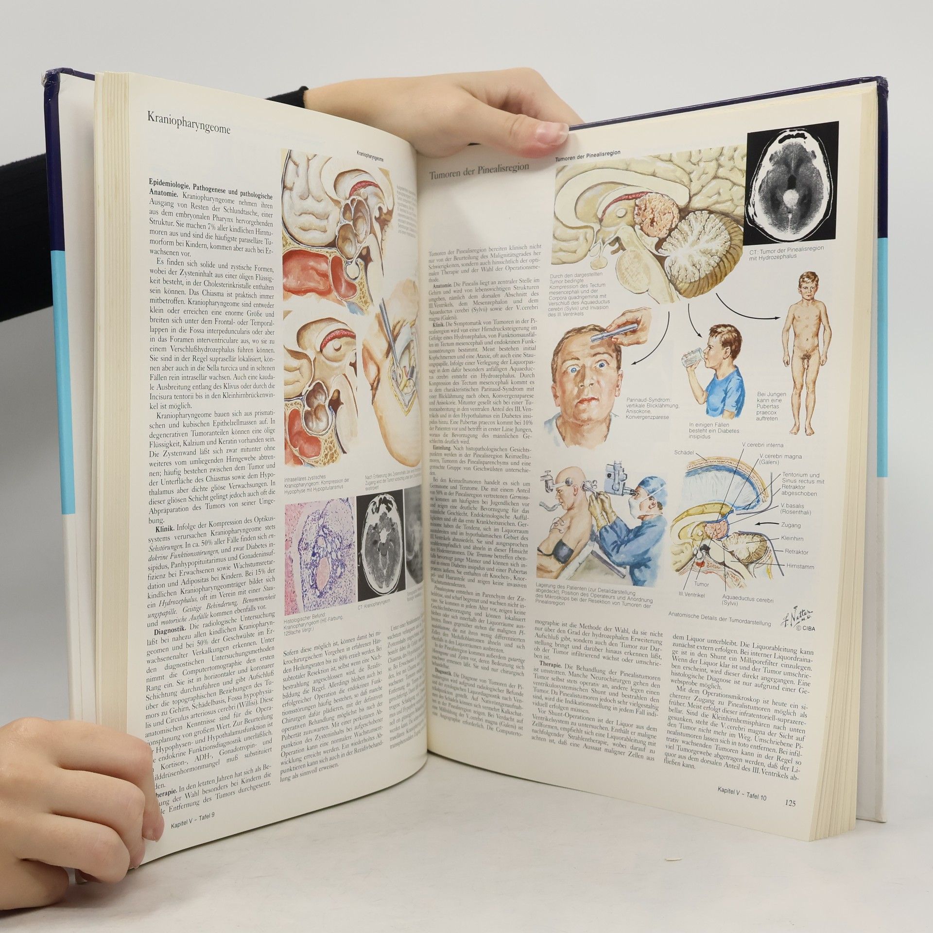 Frank H. Netter Nervensystem II. Klinische Neurologie