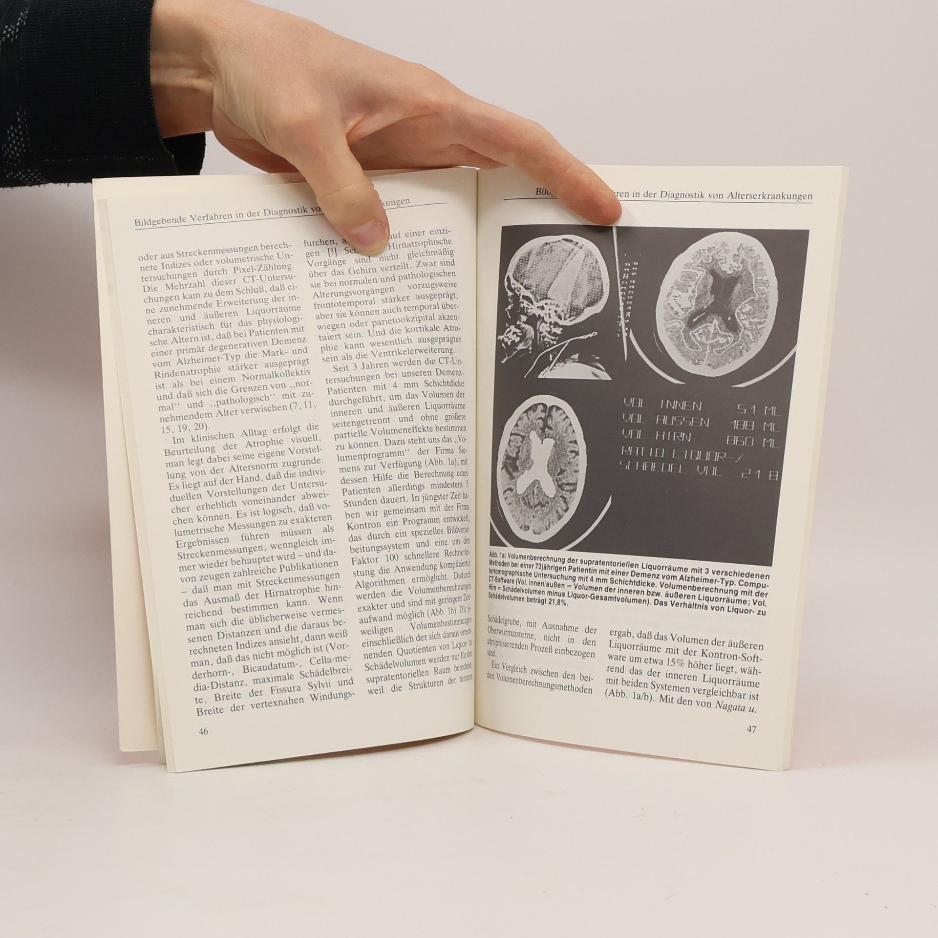 Hanns Hippius Psychiatrie für die Praxis - 8: Psychische Störungen im höheren Lebensalter