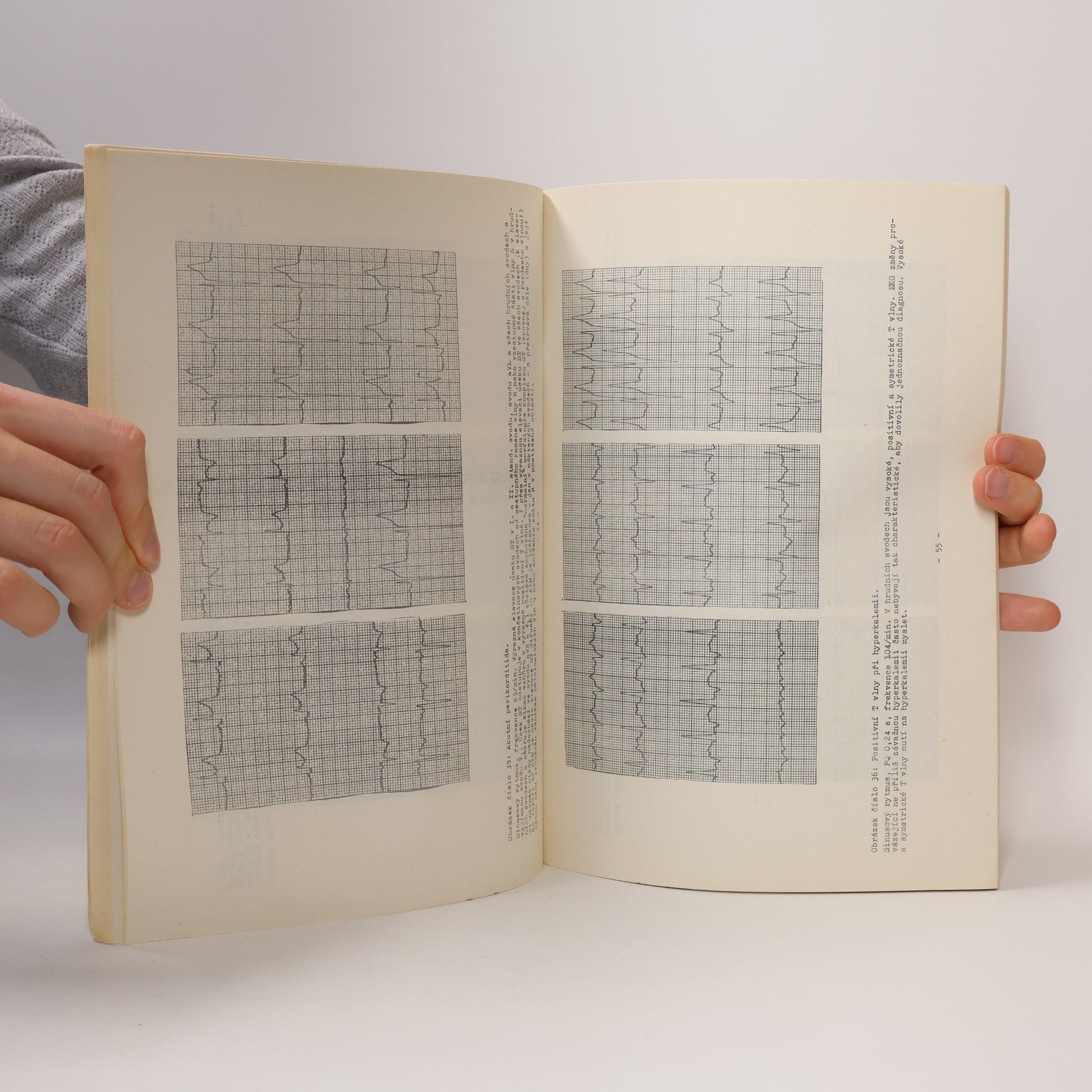Vlasta Wasyliwová Atlas EKG křivek