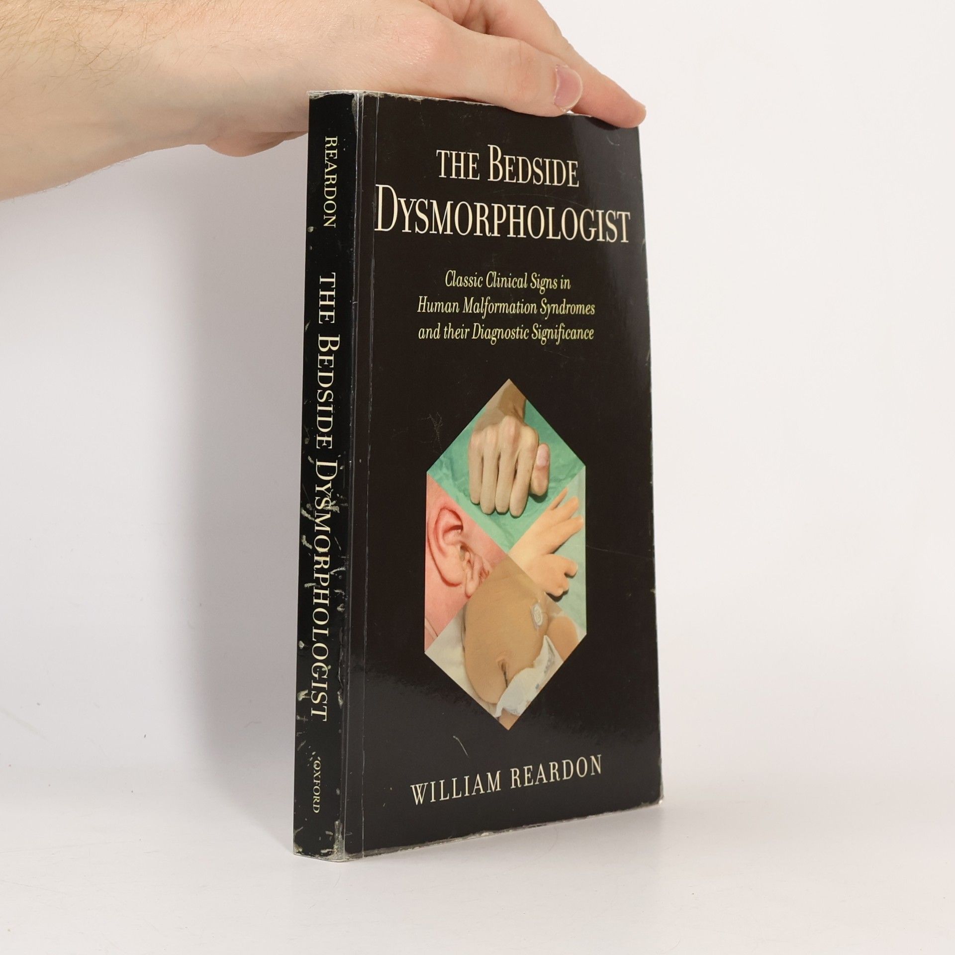 William Reardon The Bedside Dysmorphologist