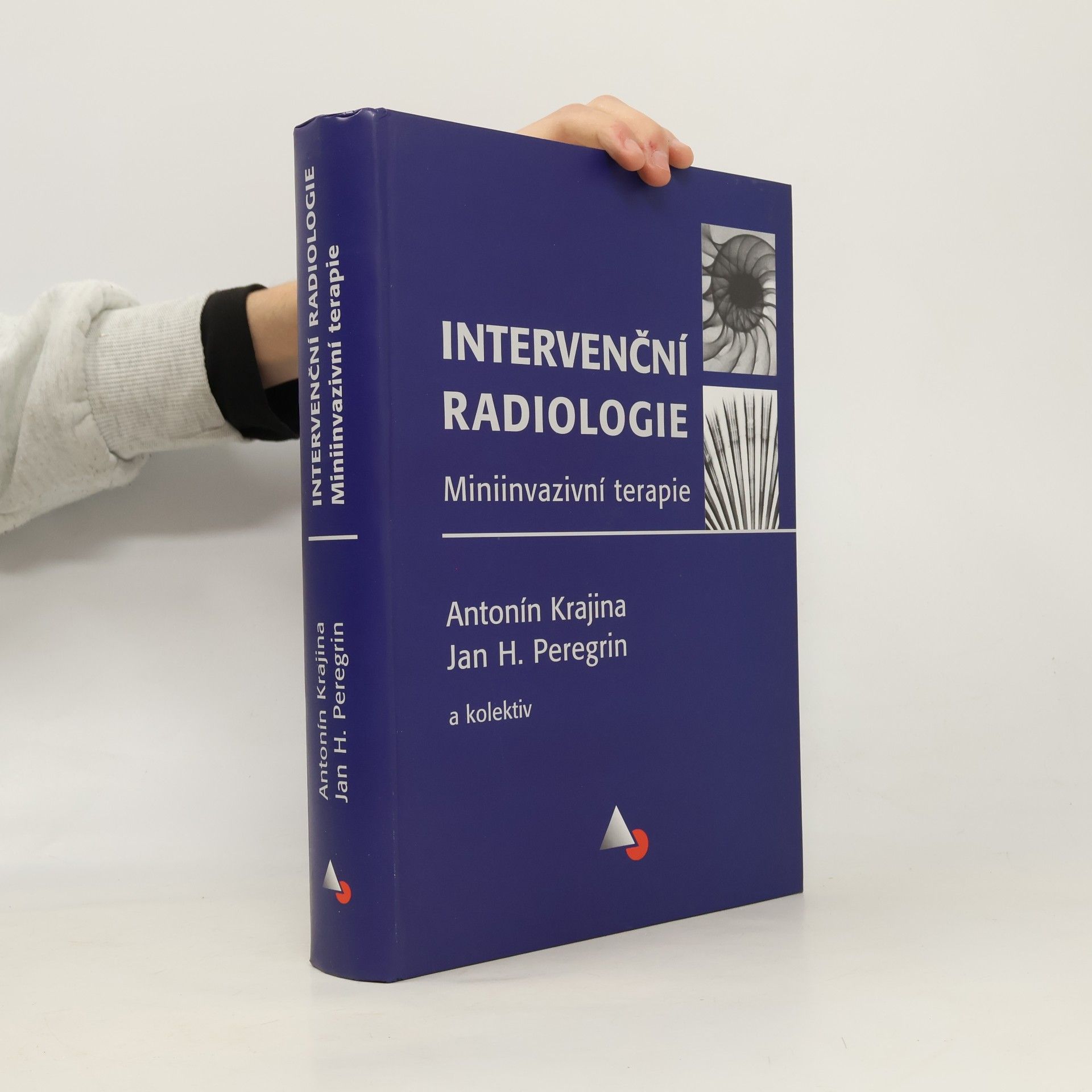 Intervenční radiologie : miniinvazivní terapie