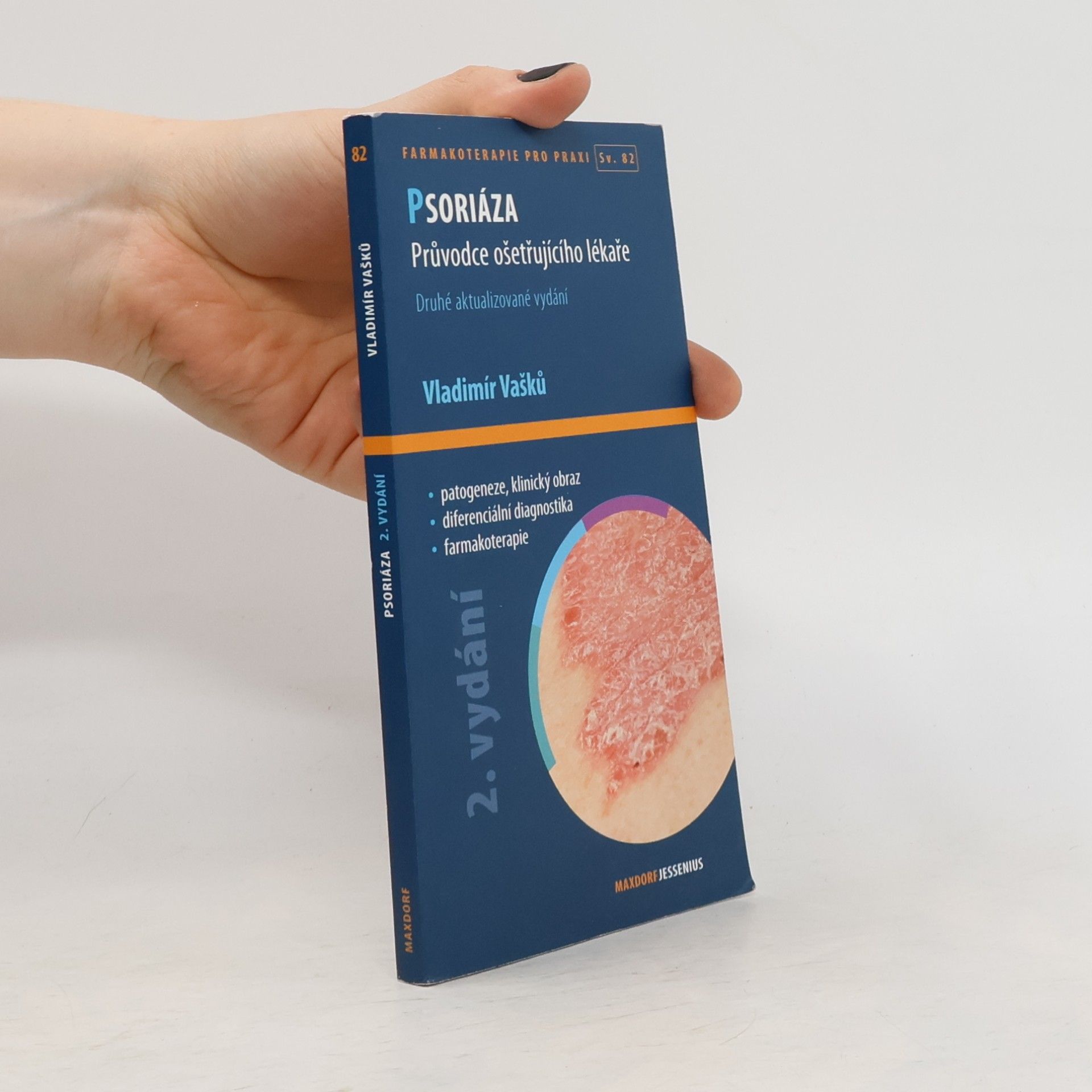Psoriáza