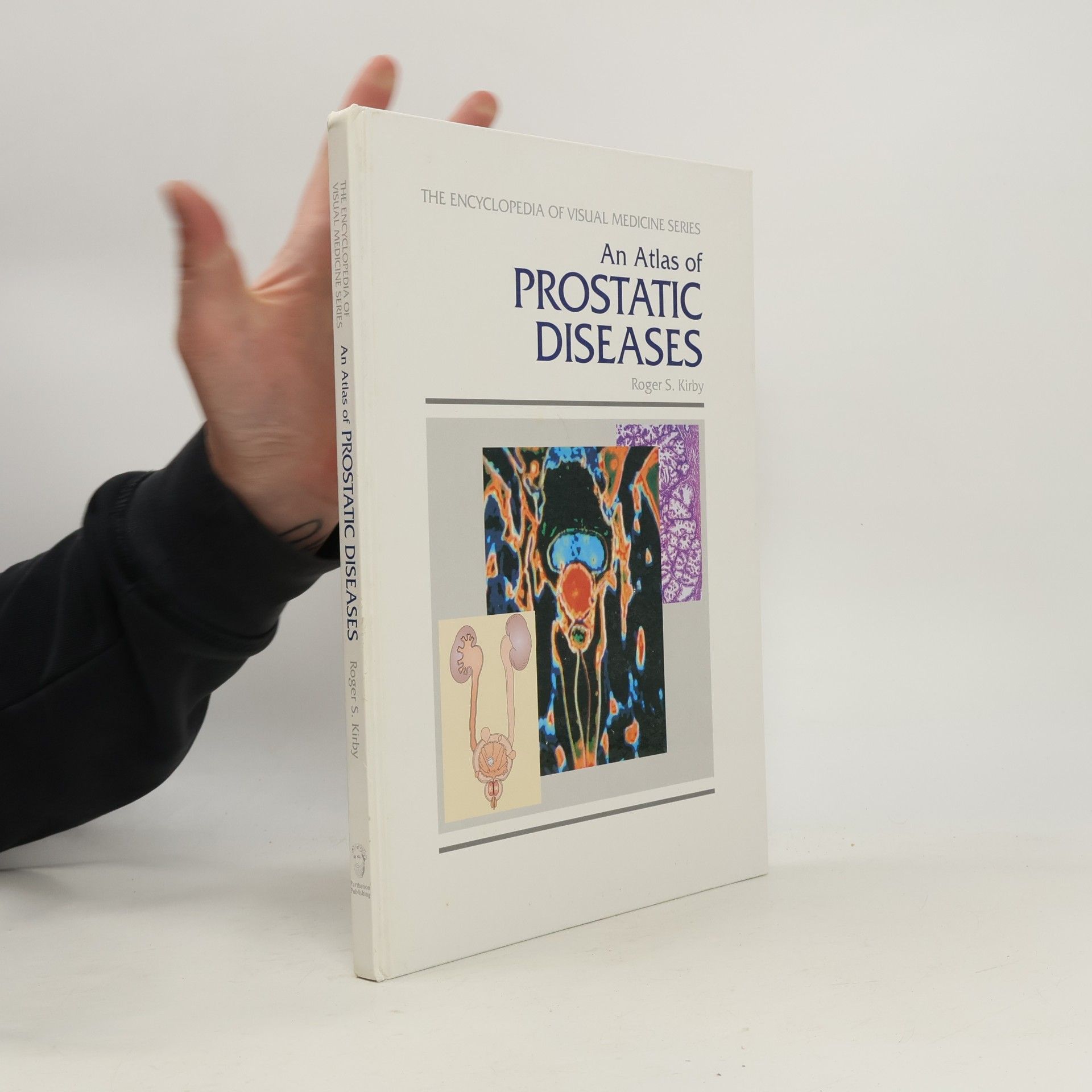 Roger S. Kirby The Encyclopedia of Visual Medicine Series: An Atlas of Prostatic Diseases