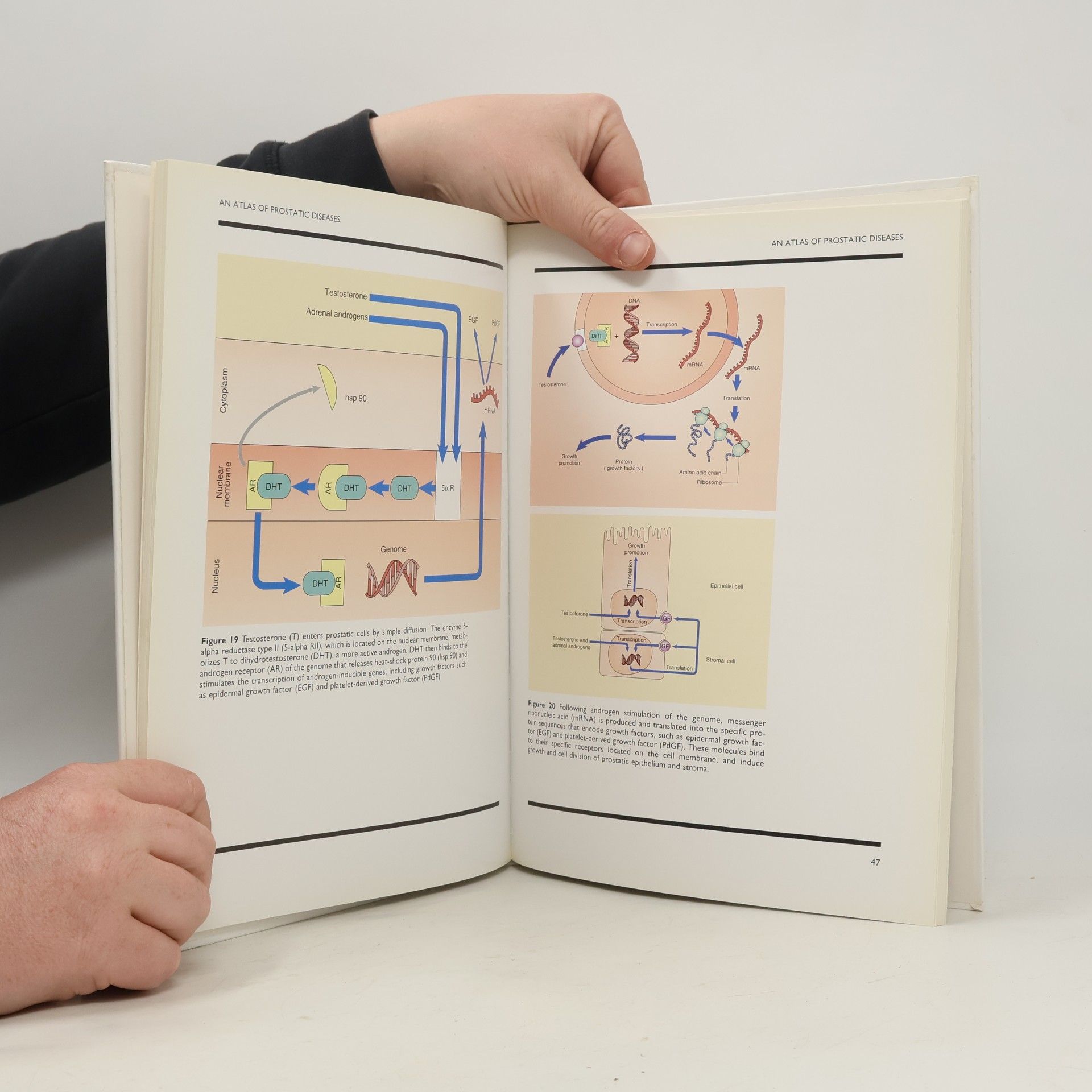 Roger S. Kirby The Encyclopedia of Visual Medicine Series: An Atlas of Prostatic Diseases