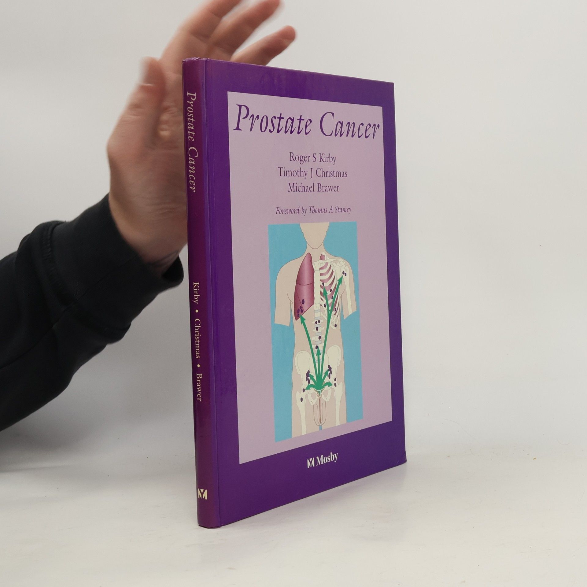 Prostate Cancer