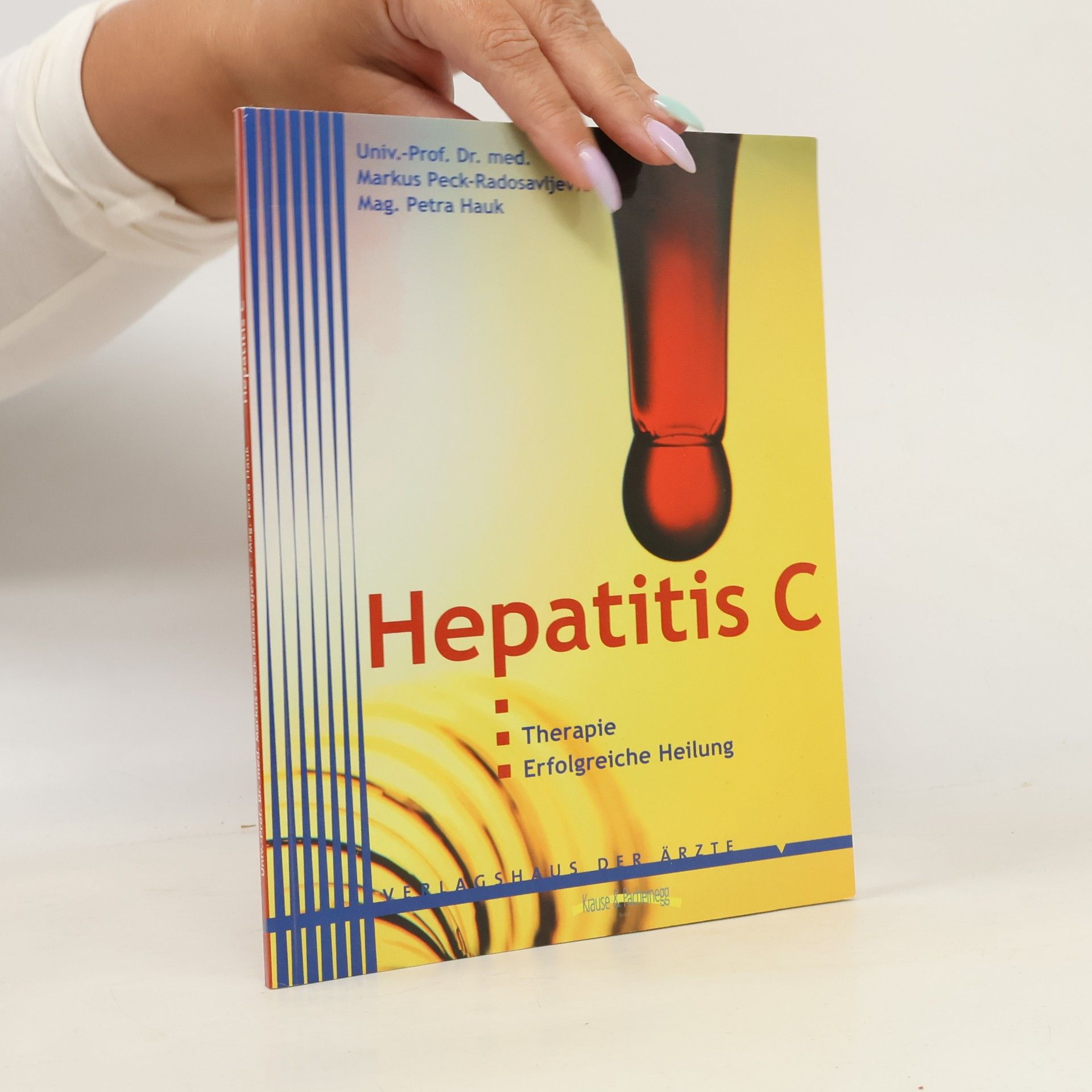 Hepatitis C