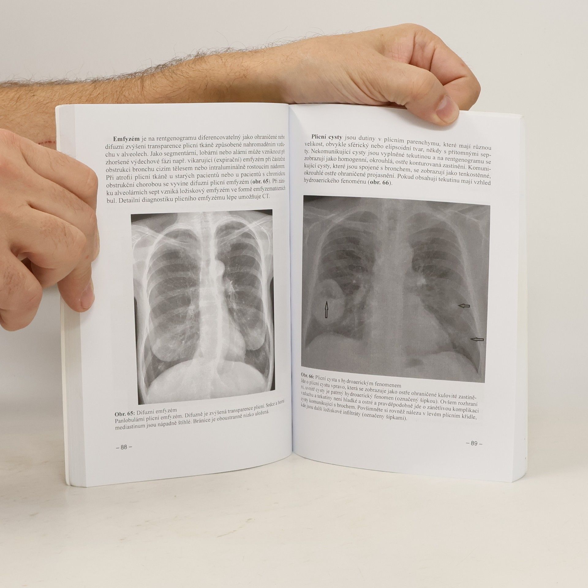 Hana Malíková Základy radiologie a zobrazovacích metod