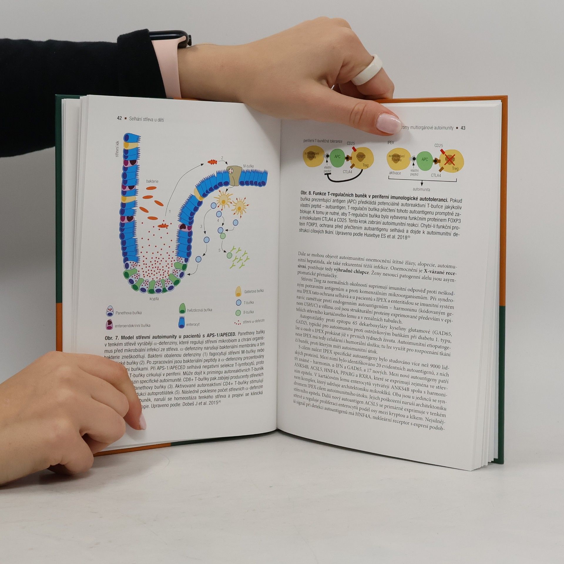 Autorenkollektiv Selhání střeva u dětí / Etiopatogeneze a terapie