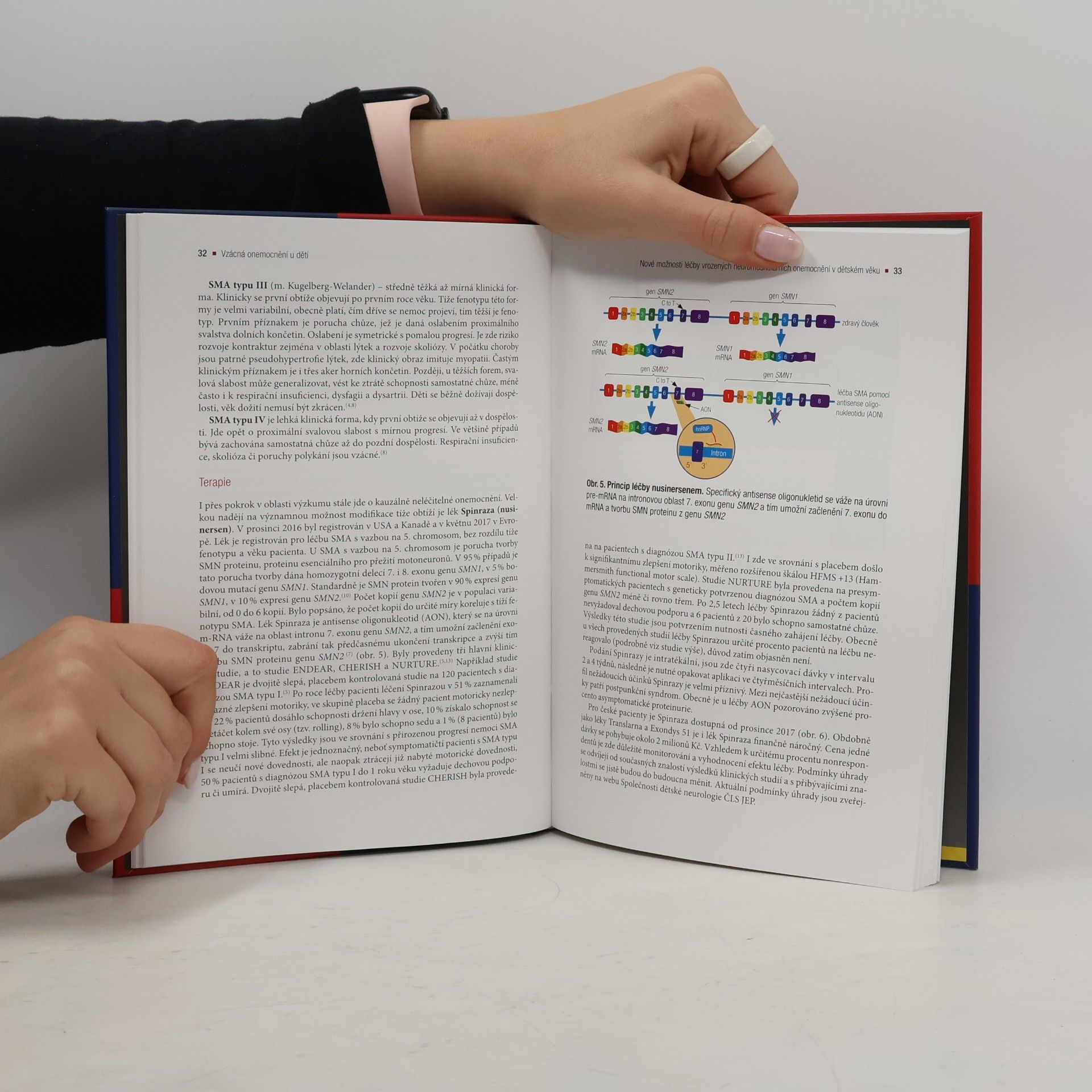 Autorenkollektiv Vzácná onemocnění u dětí : motolské pediatrické semináře 2