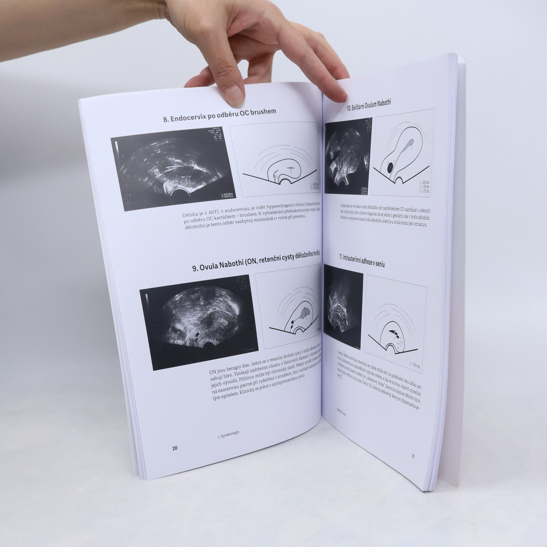 Marie Turková Přehledný ultrazvukový atlas v gynekologii a porodnictví