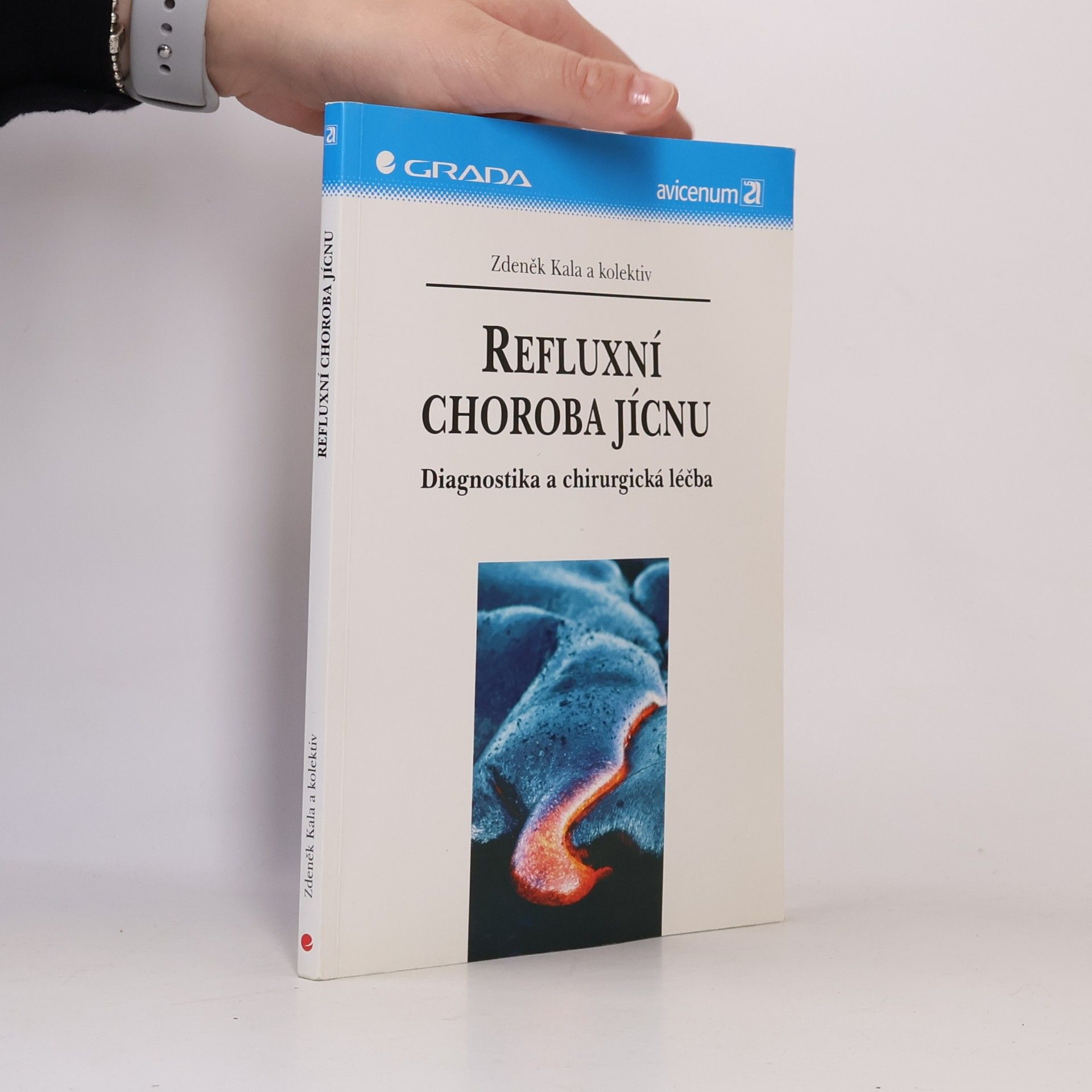Refluxní choroba jícnu : diagnostika a chirurgická léčba