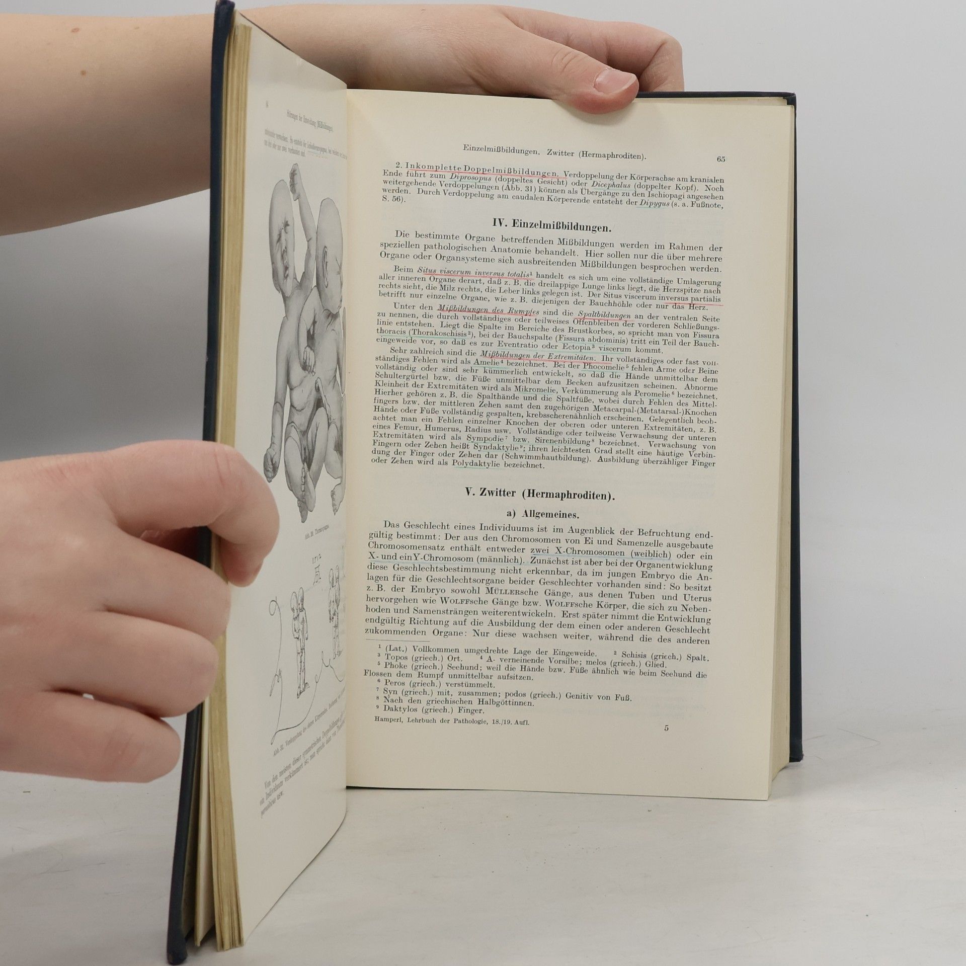 Hugo Ribbert Lehrbuch der allgemeinen Pathologie und der pathologischen Anatomie
