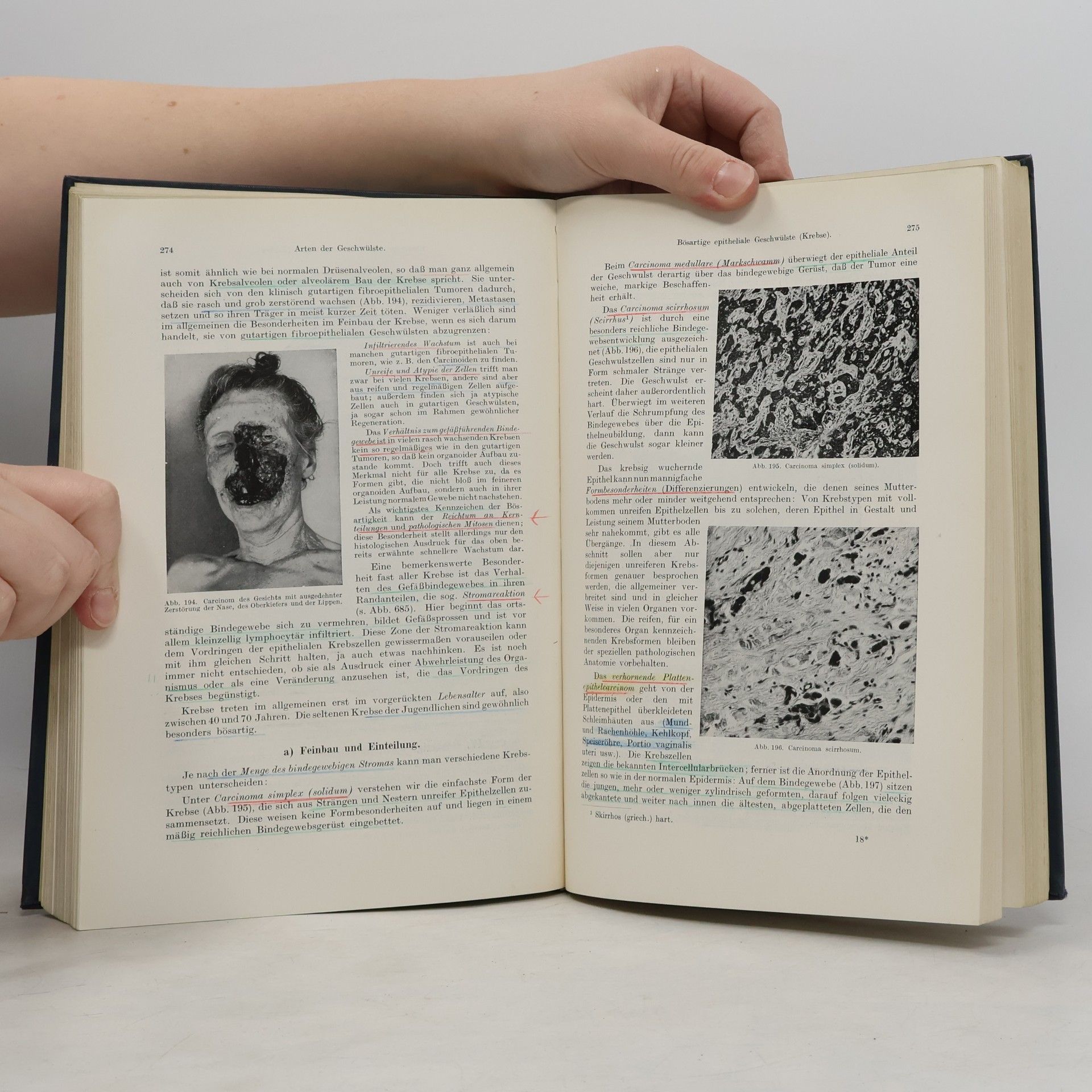 Hugo Ribbert Lehrbuch der allgemeinen Pathologie und der pathologischen Anatomie