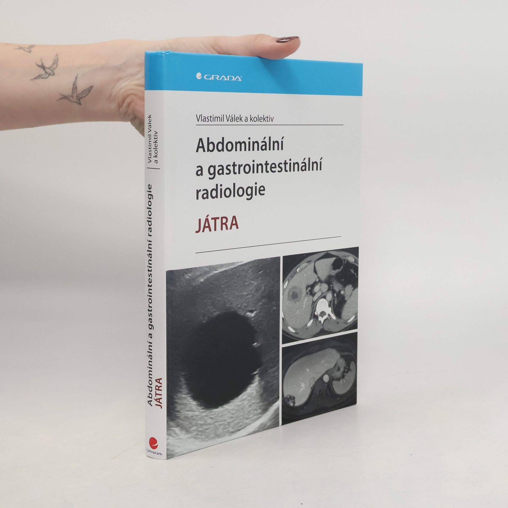 Abdominální a gastrointestinální radiologie - Játra