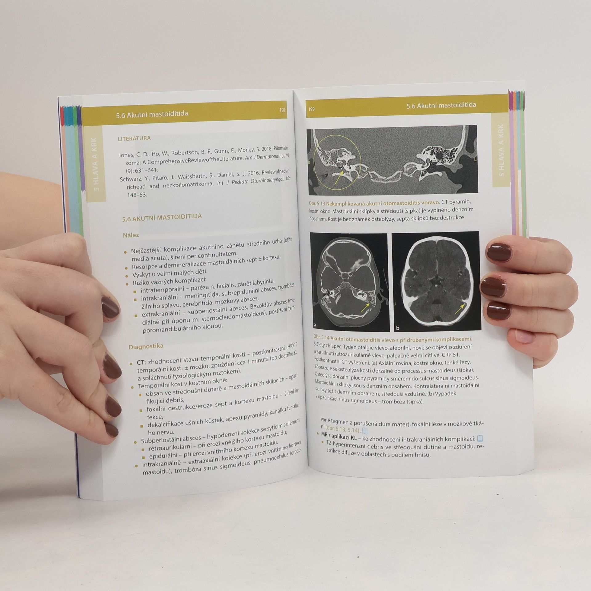 Kynčl Martin Dětská radiologie do kapsy