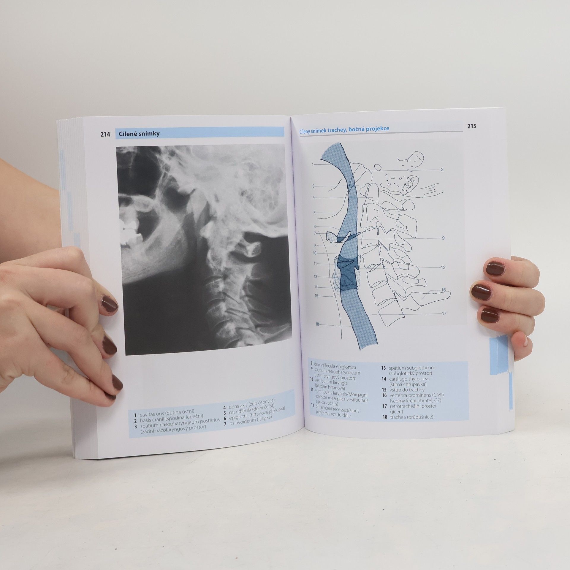 Torsten B. Möller Kapesní atlas rentgenové anatomie
