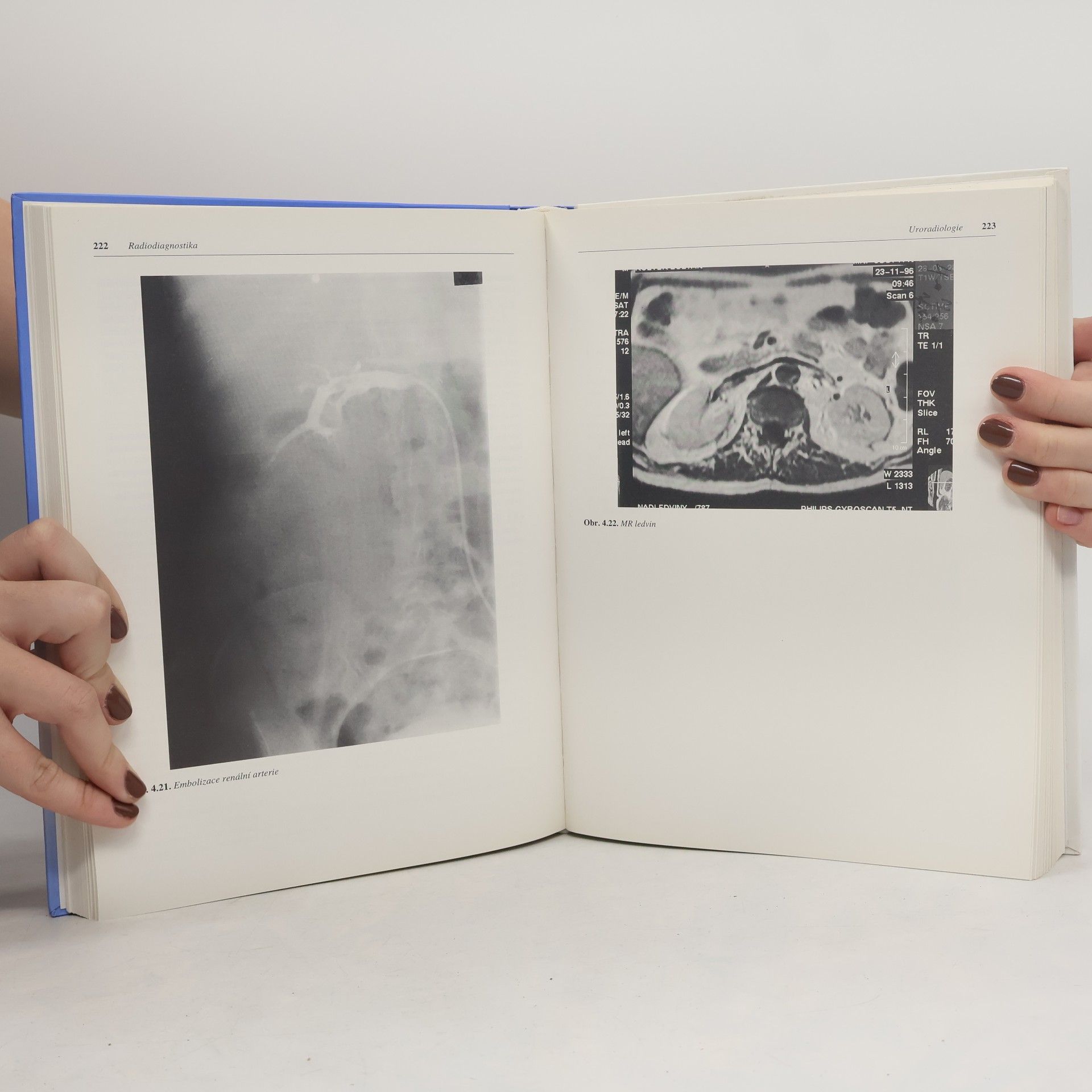 Luboš Vyhnánek Radiodiagnostika. Kapitoly z klinické praxe