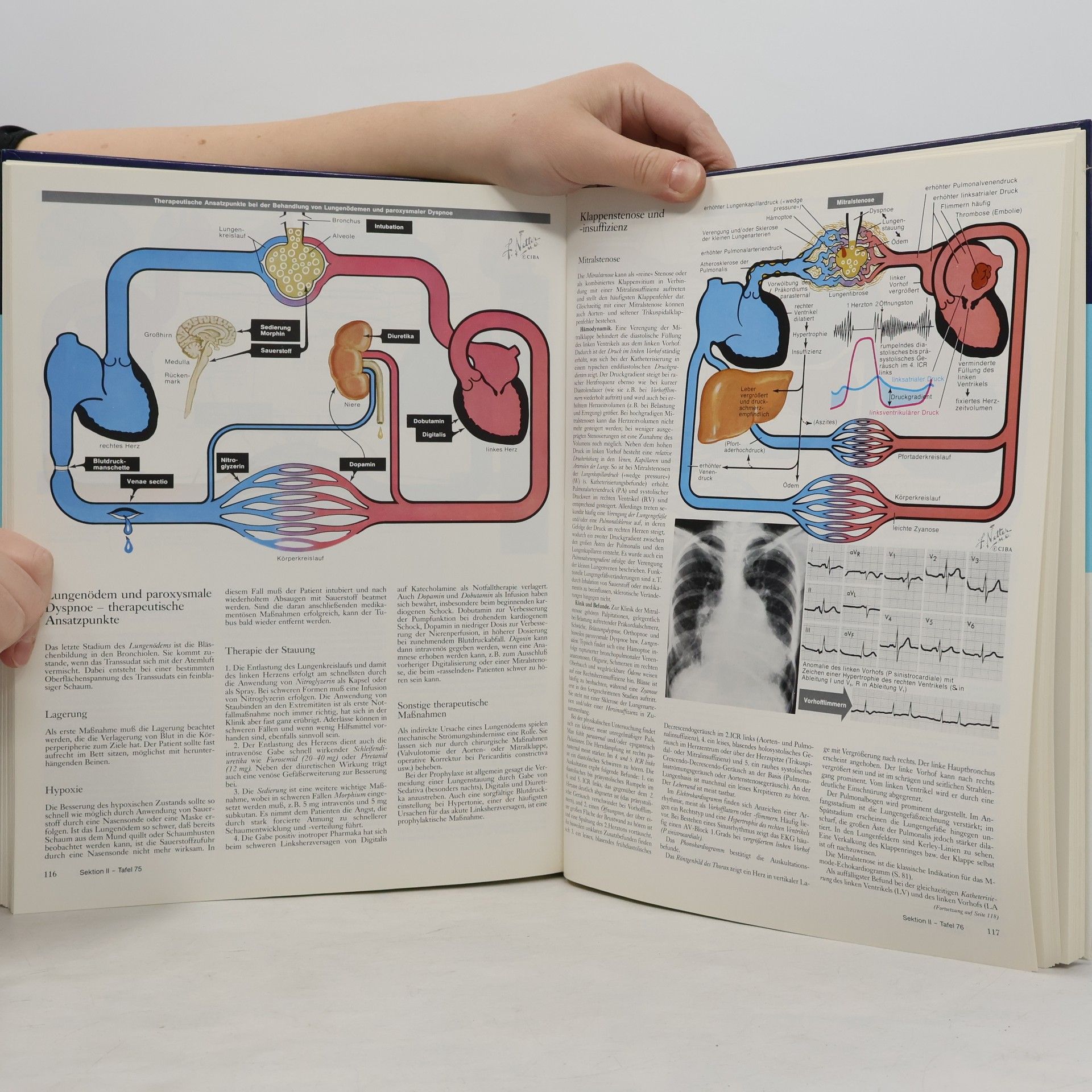 Frank Netter Farbatlanten der Medizin: The Ciba Collection of Medical Illustrations