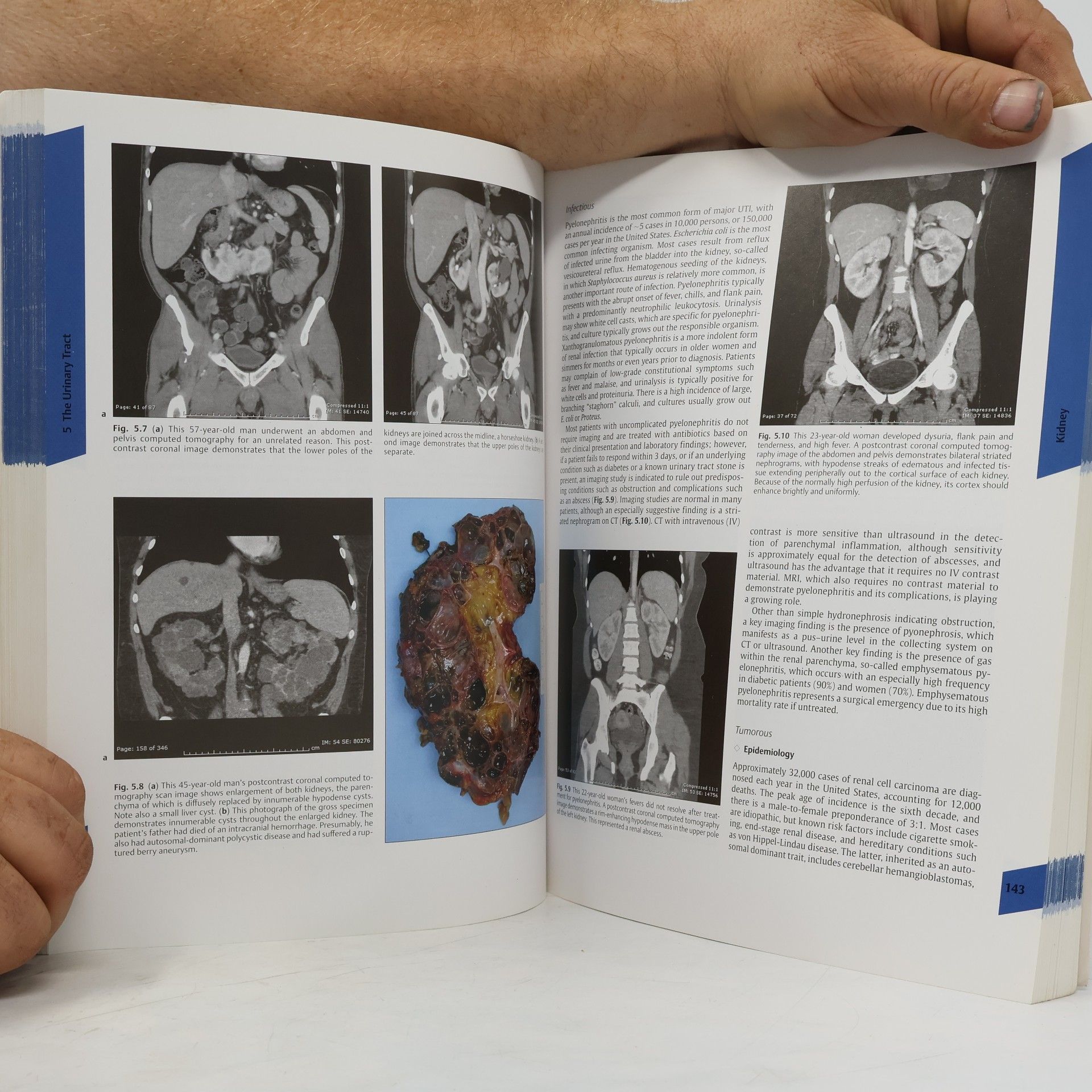 Richard B. Gunderman Essential Radiology