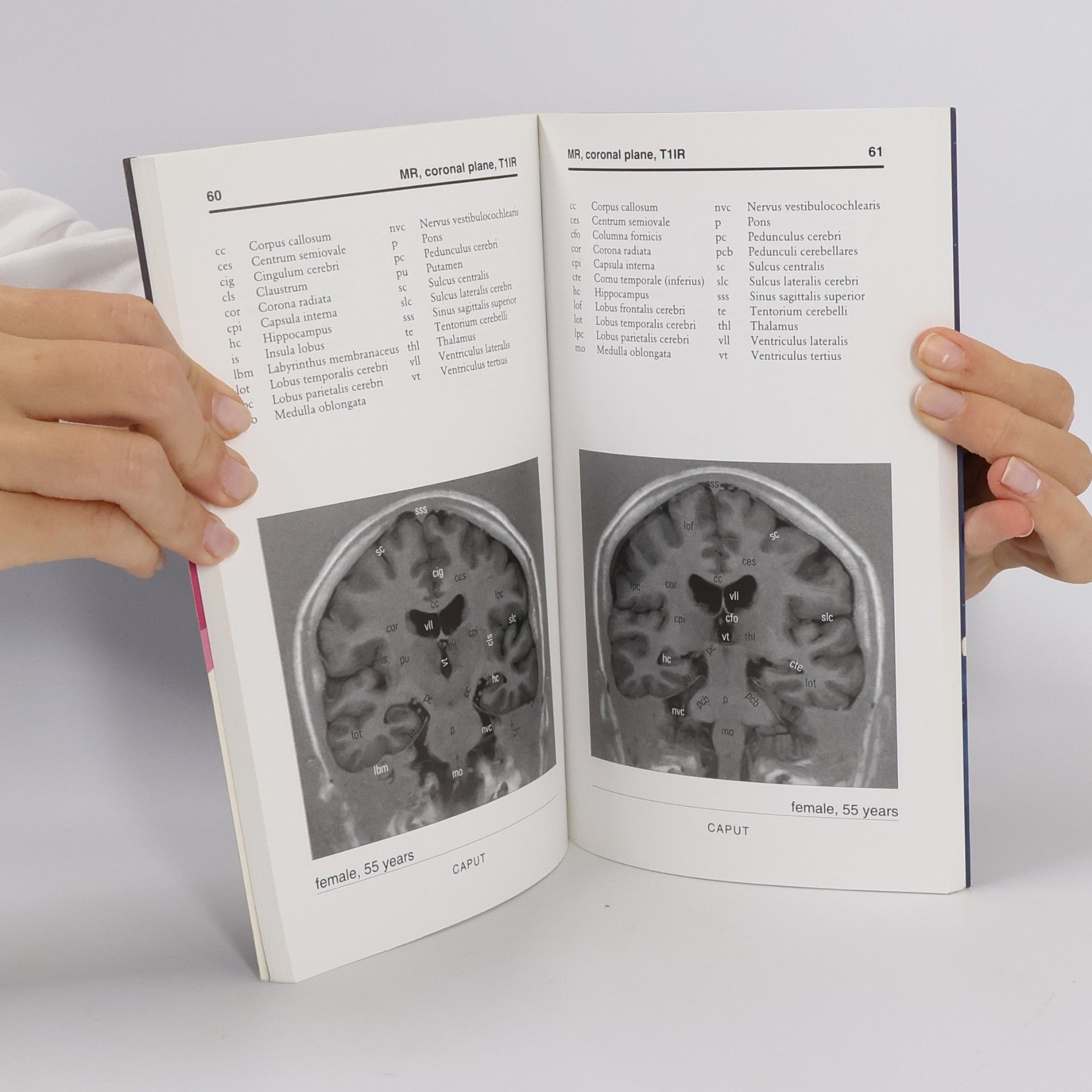 Jiří Neuwirth Anatomia Neuro Radiologica Basalis