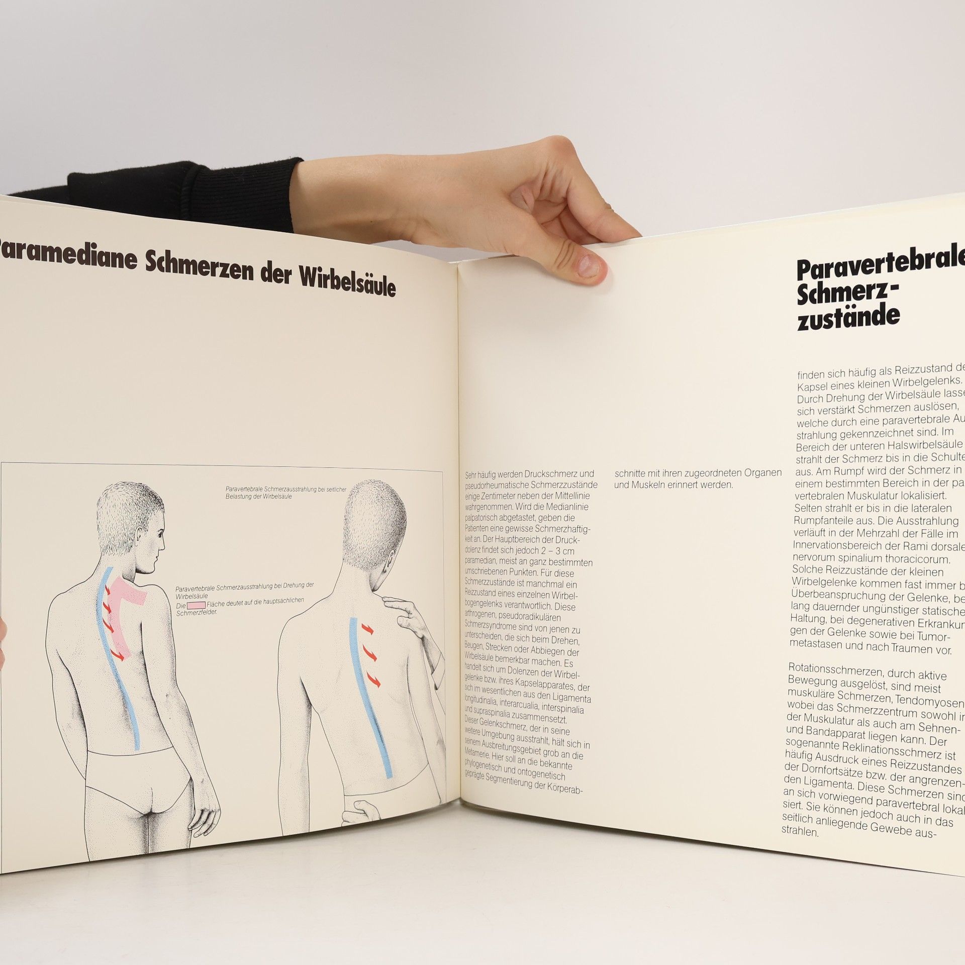 H. Schliack Exempla Neurologica. Kleiner Farbatlas zur peripheren Neurologie. Band 4