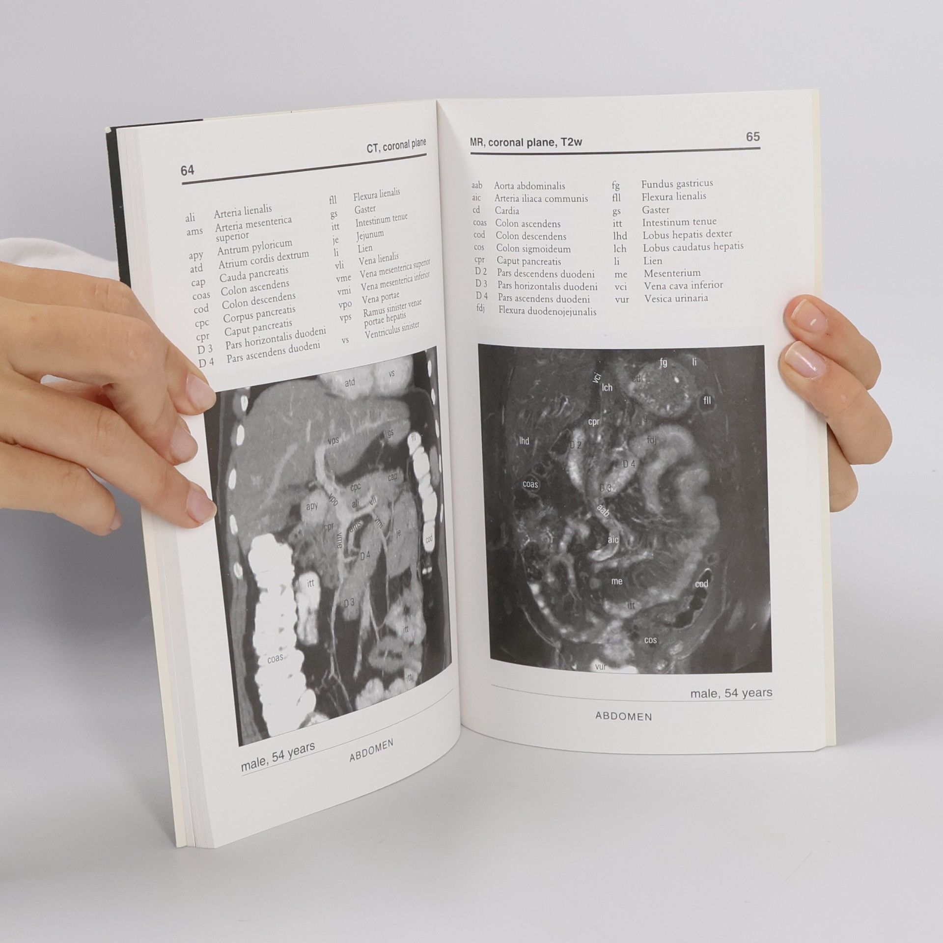 Jiří Neuwirth Anatomia Radiologica Abdominalis Basalis